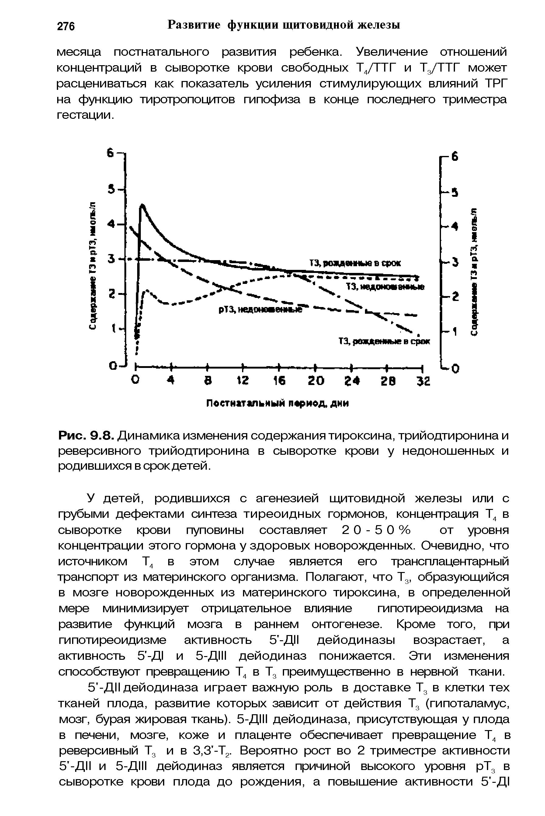 Рис. 9.8. Динамика изменения содержания тироксина, трийодтиронина и реверсивного трийодтиронина в сыворотке крови у недоношенных и родившихся в срок детей.