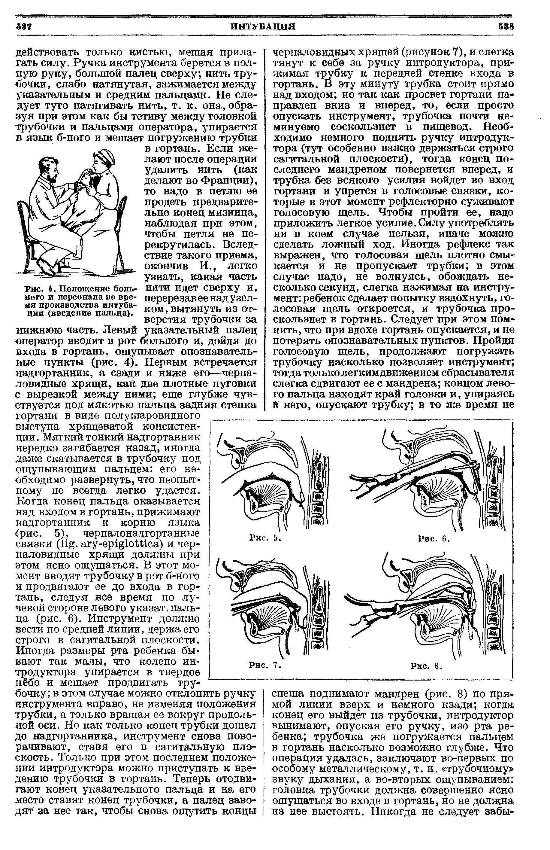 Рис. 4. Положение больного и персонала во время производства интубации (введение пальца).