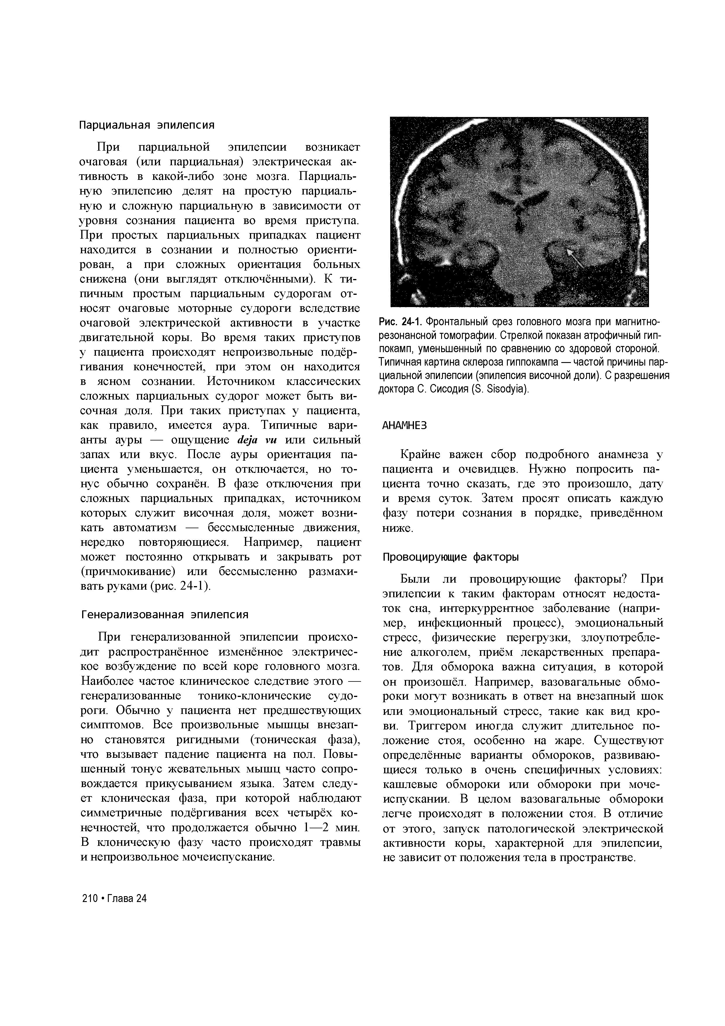 Рис. 24-1. Фронтальный срез головного мозга при магнитно-резонансной томографии. Стрелкой показан атрофичный гиппокамп, уменьшенный по сравнению со здоровой стороной. Типичная картина склероза гиппокампа — частой причины парциальной эпилепсии (эпилепсия височной доли). С разрешения доктора С. Сисодия (Э. 3 эос у а).