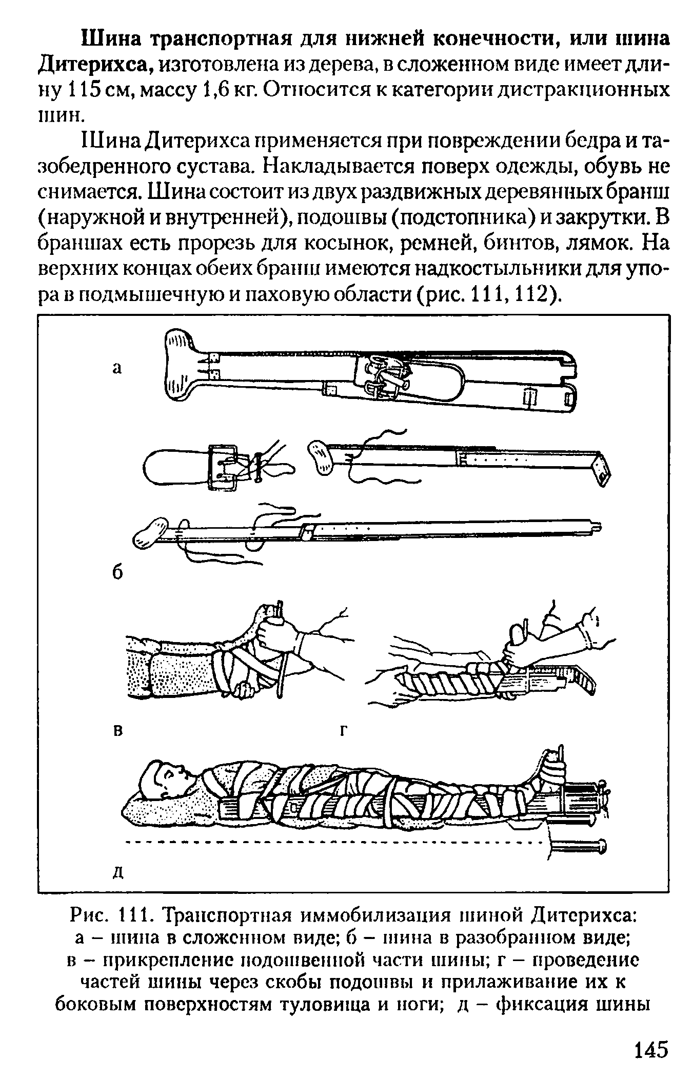 Рис. 111. Транспортная иммобилизация шиной Дитерихса а - шина в сложенном виде б - шина в разобранном виде в - прикрепление подошвенной части шины г - проведение частей шины через скобы подошвы и прилаживание их к боковым поверхностям туловища и ноги д - фиксация шины...