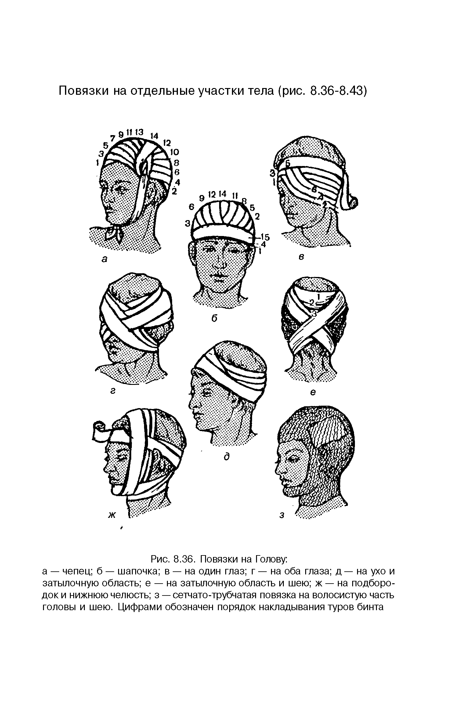 Рис. 8.36. Повязки на Голову а — чепец б — шапочка в — на один глаз г-на оба глаза д — на ухо и затылочную область е — на затылочную область и шею ж — на подбородок и нижнюю челюсть з — сетчато-трубчатая повязка на волосистую часть головы и шею. Цифрами обозначен порядок накладывания туров бинта...