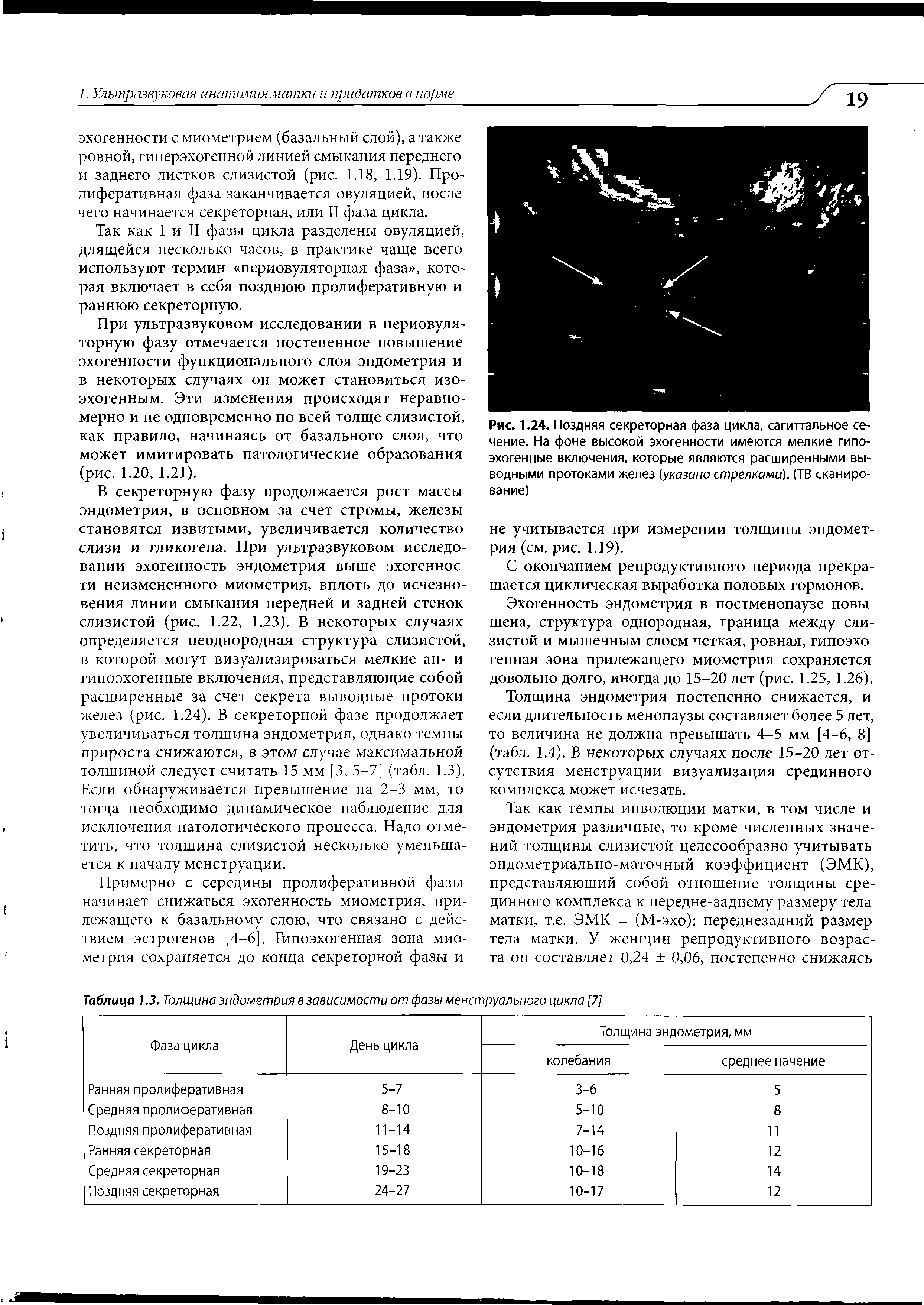 Рис. 1.24. Поздняя секреторная фаза цикла, сагиттальное сечение. На фоне высокой эхогенности имеются мелкие гипоэхогенные включения, которые являются расширенными выводными протоками желез. указано стрелками). (ТВ сканирование)...