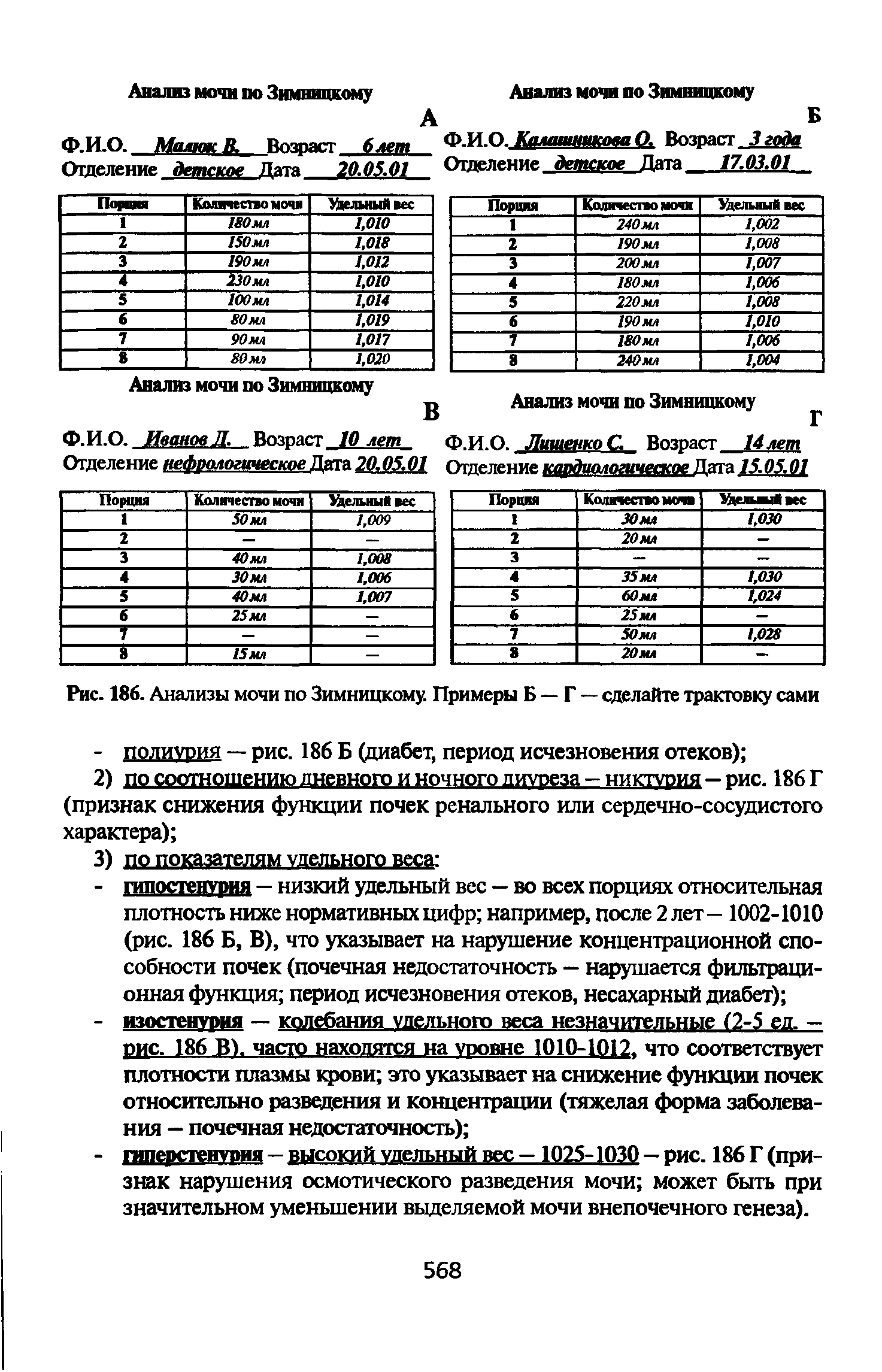 Рис. 186. Анализы мочи по Зимницкому. Примеры Б — Г — сделайте трактовку сами...