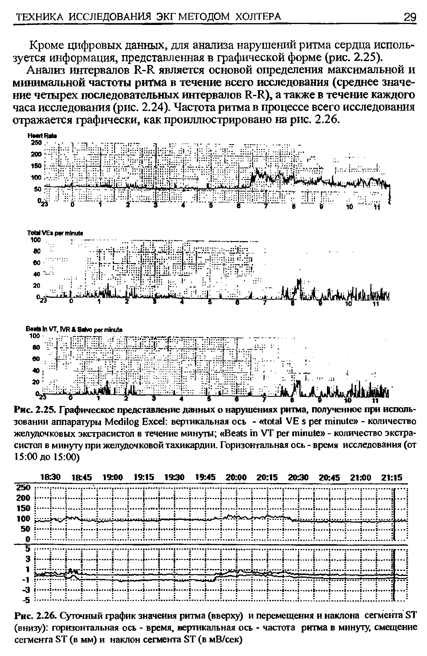 Рис. 2.26. Суточный график значения ритма (вверху) и перемещения и наклона сегмента 8Т (внизу) горизонтальная ось - время, вертикальная ось - частота ритма в минуту, смещение сегмента ЯТ (в мм) и наклон сегмента ЯТ (в мВ/сек)...