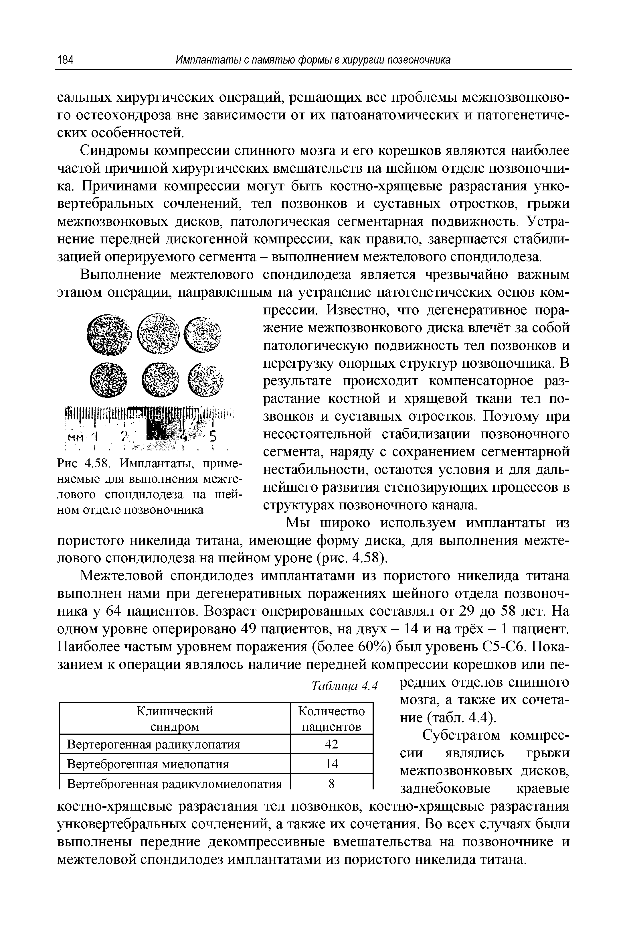 Рис. 4.58. Имплантаты, применяемые для выполнения межтелового спондилодеза на шейном отделе позвоночника...