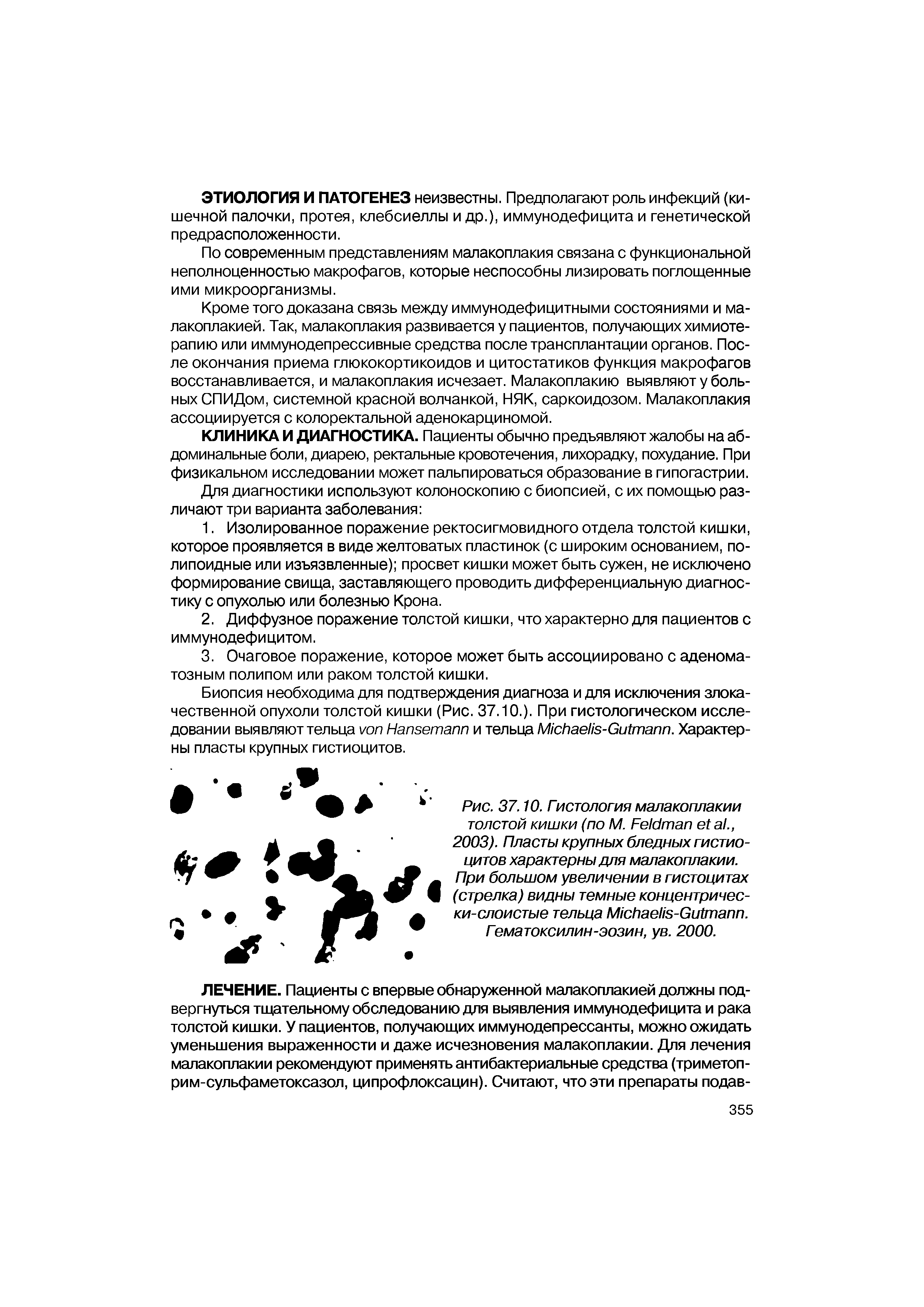 Рис. 37.10. Гистология малакоплакии толстой кишки (по М. F ., 2003). Пласты крупных бледных гистиоцитов характерны для малакоплакии.