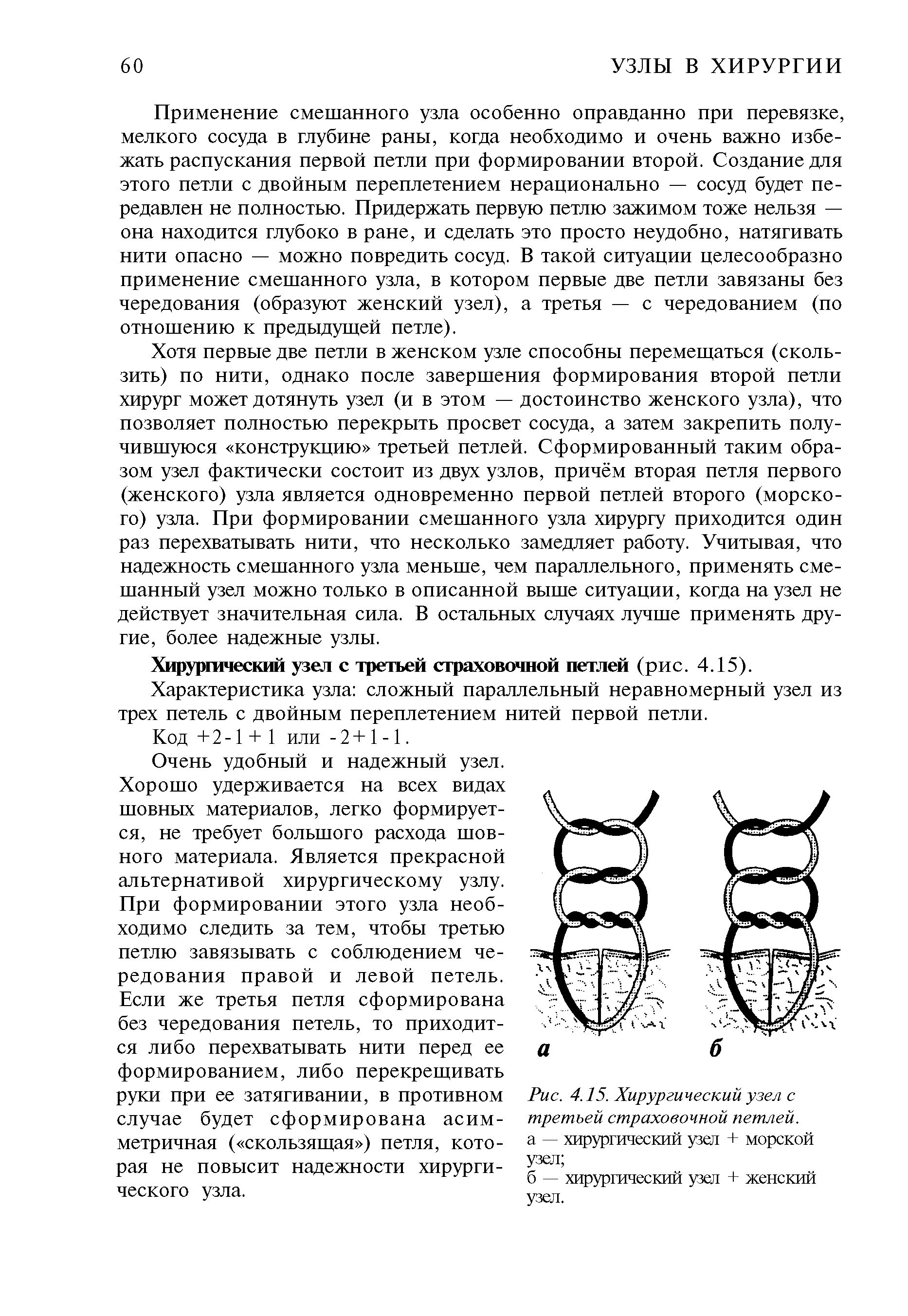 Рис. 4.15. Хирургический узел с третьей страховочной петлей. а — хирургический узел + морской узел ...