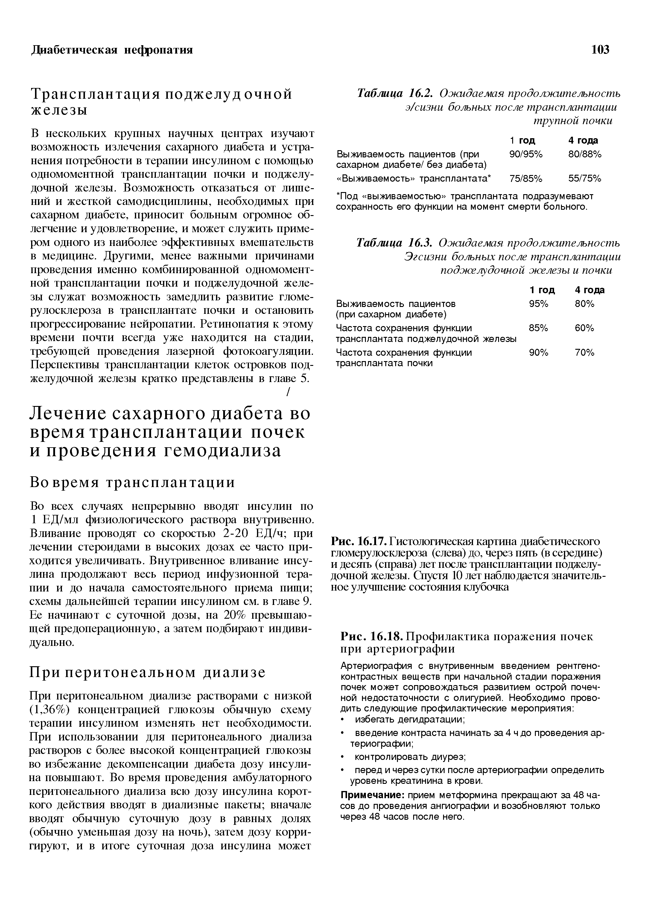 Рис. 16.17. Гистологическая картина диабетического гломерулосклероза (слева) до, через ия1ь (в середине) и деся1ь (справа) лет после трансплантации поджелудочной железы. Спустя 10 лет наблюдается значительное улучшение состояния клубочка...