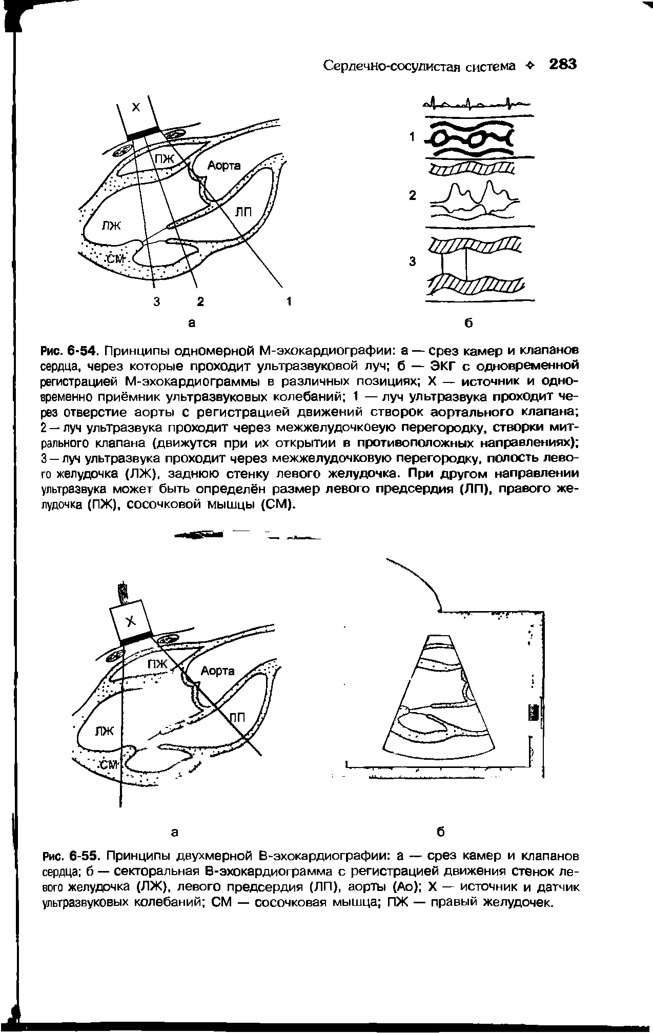 Рис. 6-55. Принципы двухмерной В-эхокардиографии а — срез камер и клапанов сердца б — секторальная В-эхокардиограмма с регистрацией движения стенок левого желудочка (ЛЖ), левого предсердия (ЛП), аорты (Ао) X — источник и датчик ультразвуковых колебаний СМ — сосочковая мышца ПЖ — правый желудочек.