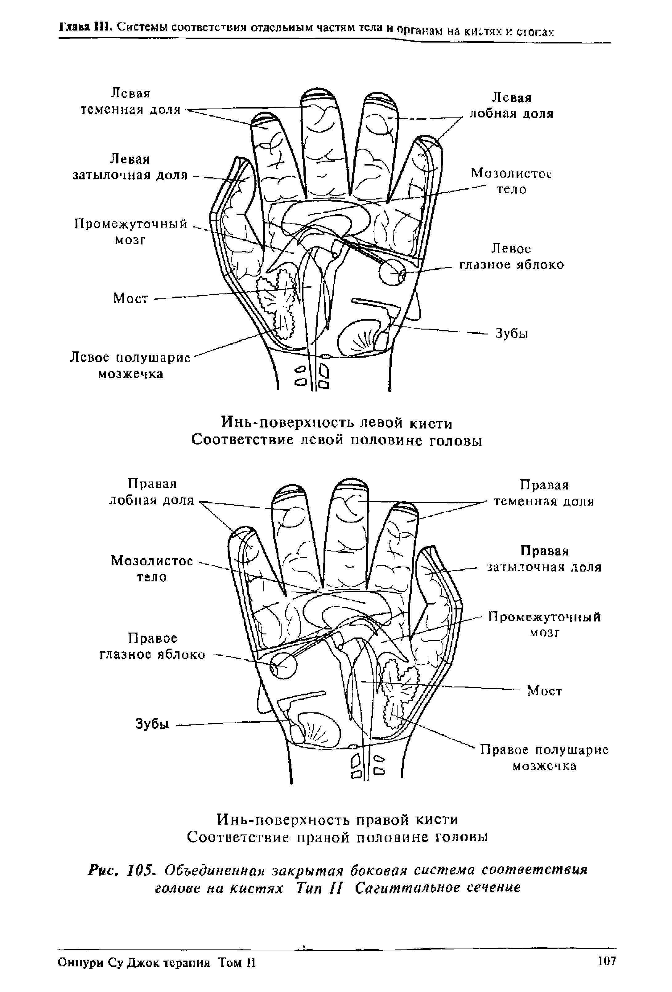 Рис. 105. Объединенная закрытая боковая система соответствия голове на кистях Тип II Сагиттальное сечение...
