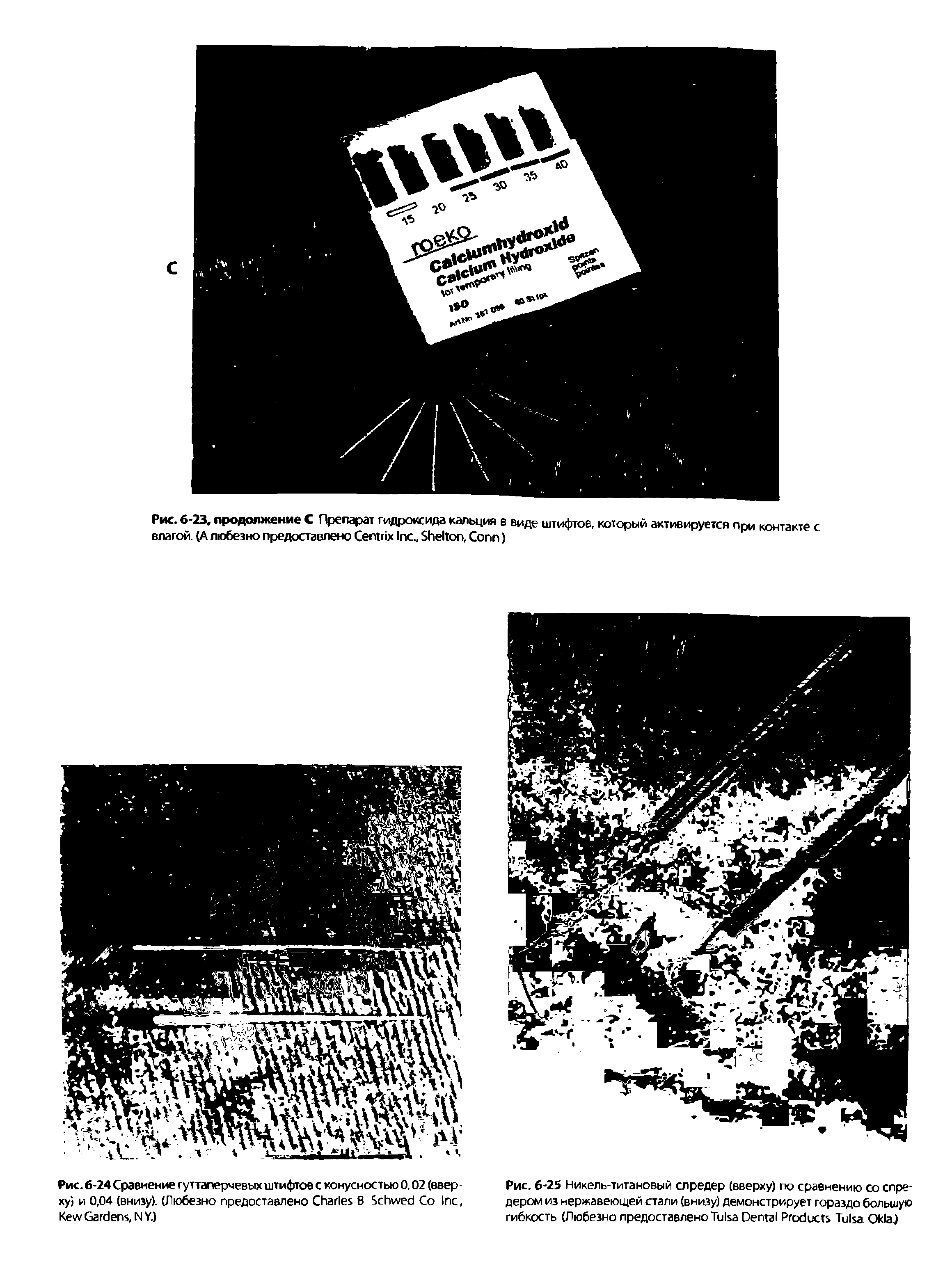 Рис. 6-25 Никель-титановый слредер (вверху) по сравнению со спредером из нержавеющей стали (внизу) демонстрирует гораздо большую гибкость (Любезно предоставлено T D P T O J...