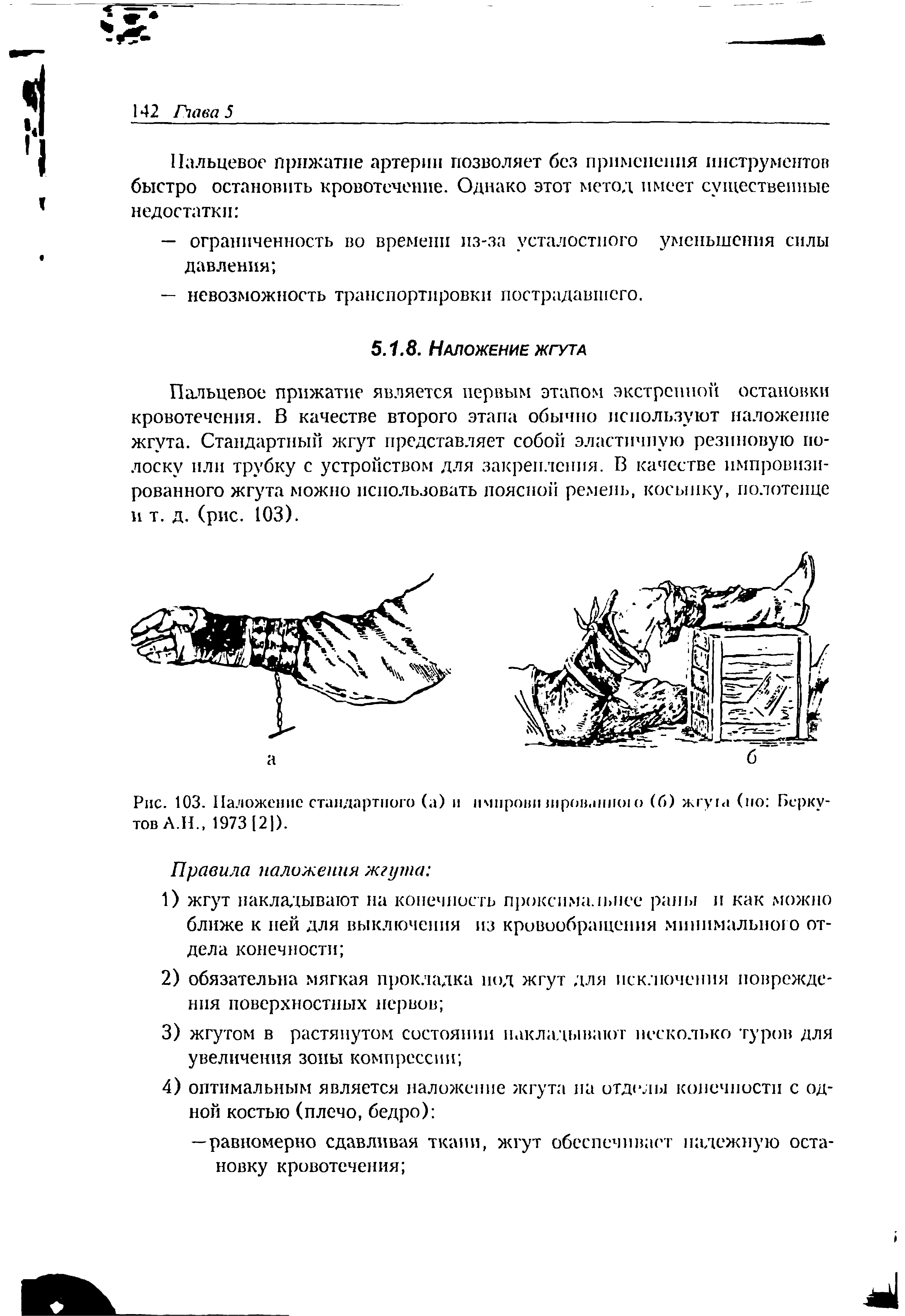 Рис. 103. Наложение стандартного (а) и нмпрови шров.шшио (б) жгу га (но Беркутов А.Н., 1973 [2]).
