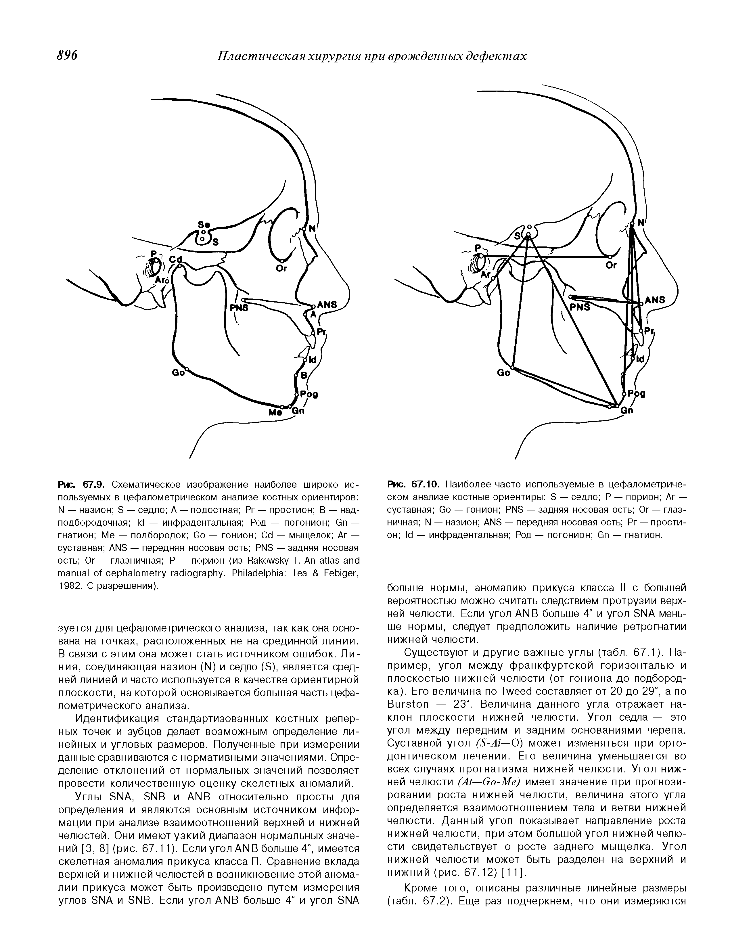 Рис. 67.10. Наиболее часто используемые в цефалометрическом анализе костные ориентиры S — седло Р — порион Аг — суставная G — гонион PNS — задняя носовая ость Ог — глазничная N — назион ANS — передняя носовая ость Рг — простион — инфрадентальная Род — погонион G — гнатион.