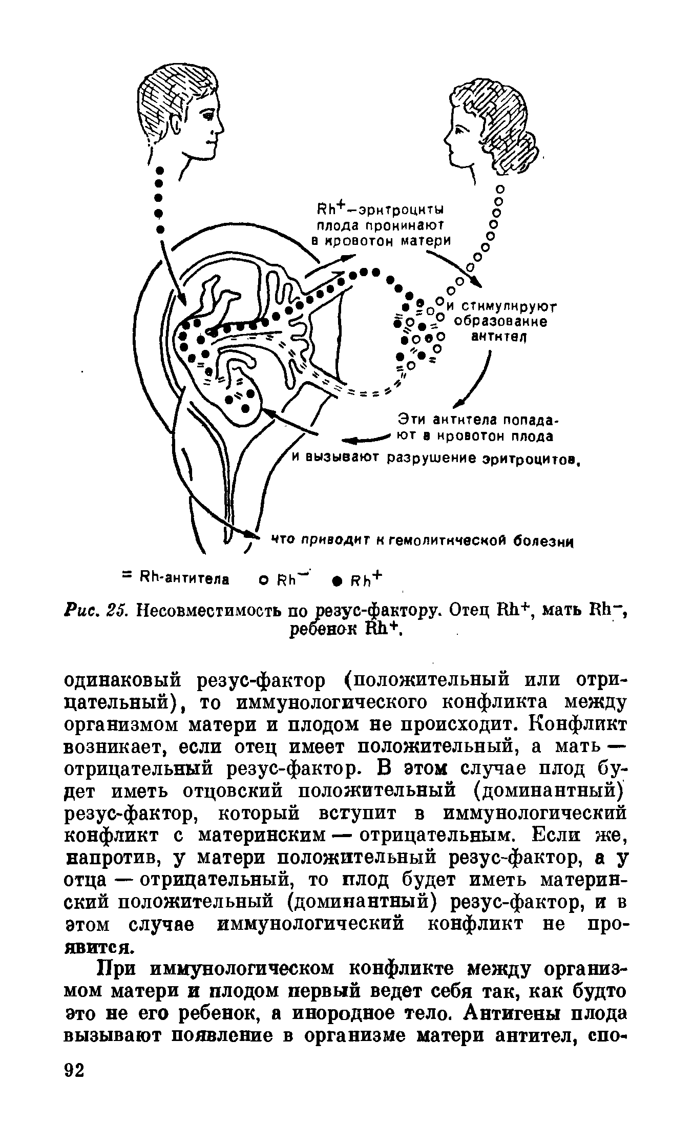 Рис. 25. Несовместимость по резус-фактору. Отец ИЬ+, мать КЬ, реоенок Йй+.