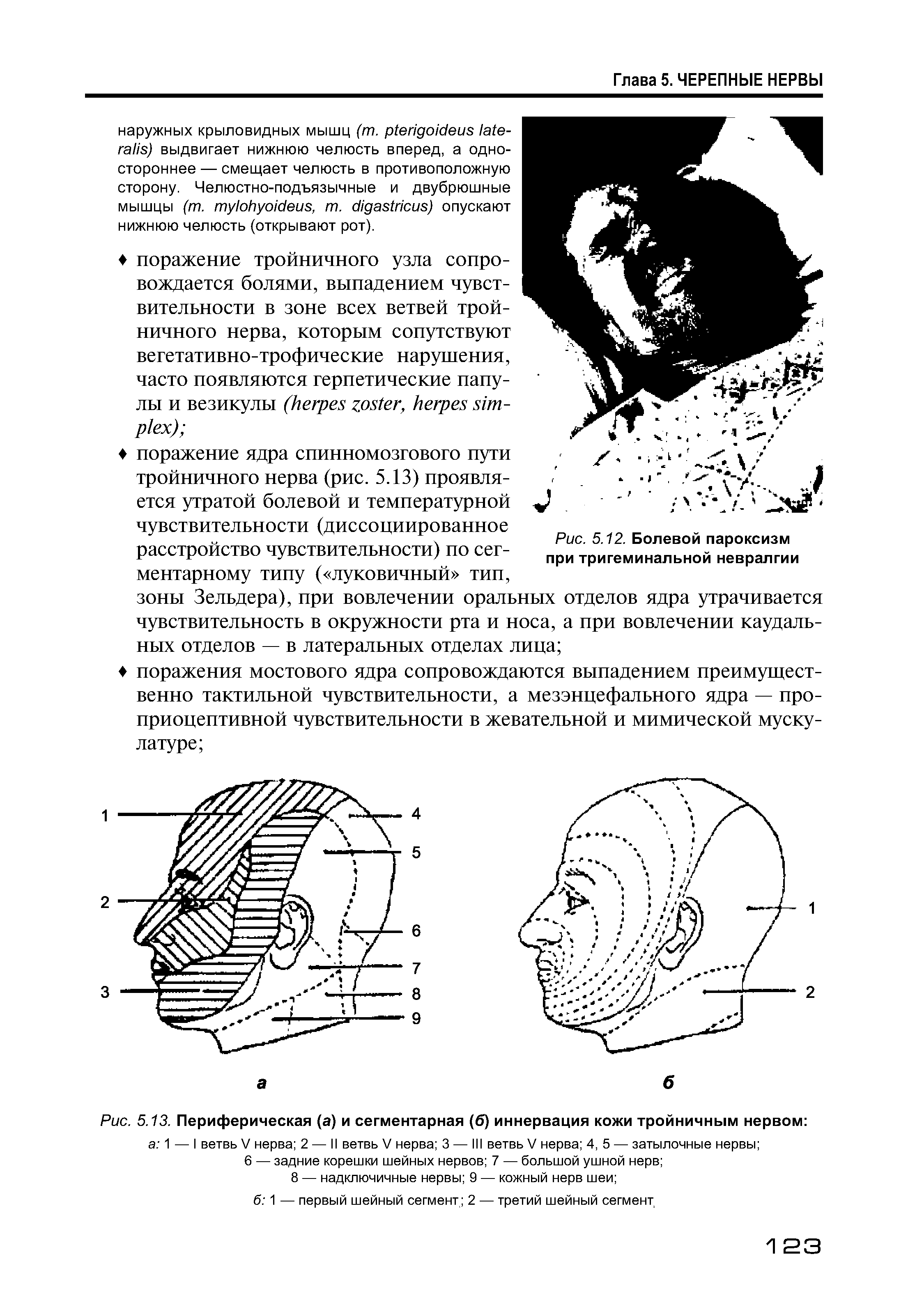 Рис. 5.13. Периферическая (а) и сегментарная (6) иннервация кожи тройничным нервом а 1 — I ветвь V нерва 2 — II ветвь V нерва 3 — III ветвь V нерва 4, 5 — затылочные нервы ...