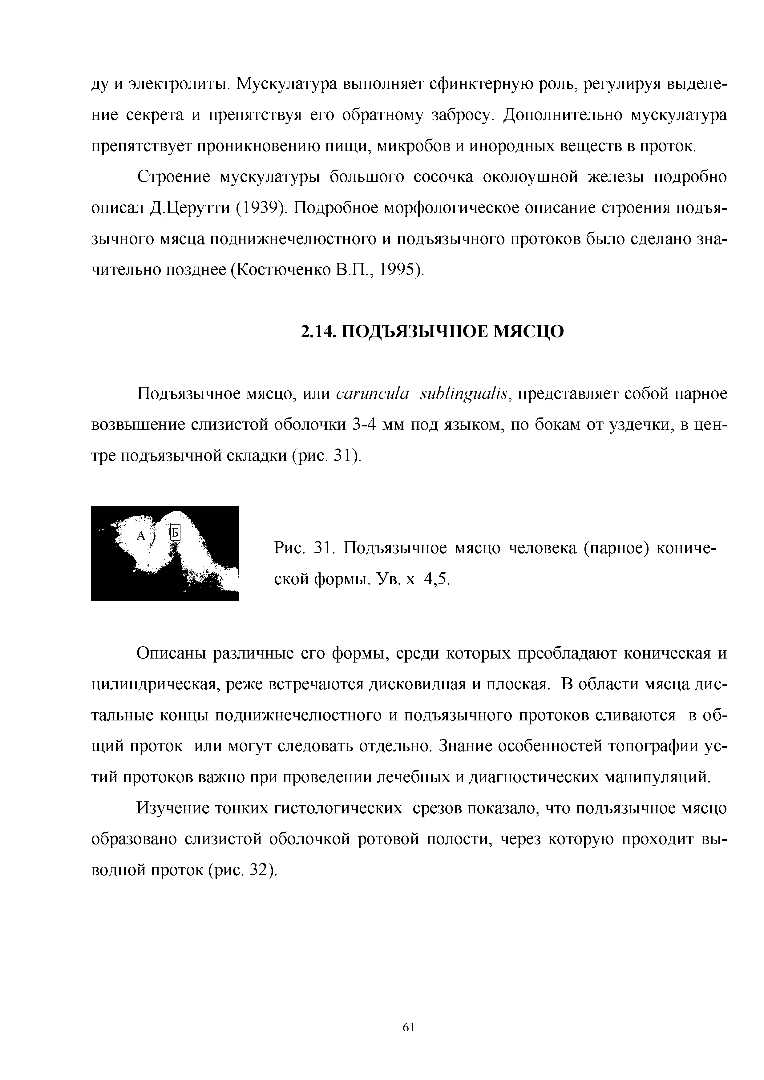 Рис. 31. Подъязычное мясцо человека (парное) конической формы. Ув. х 4,5.