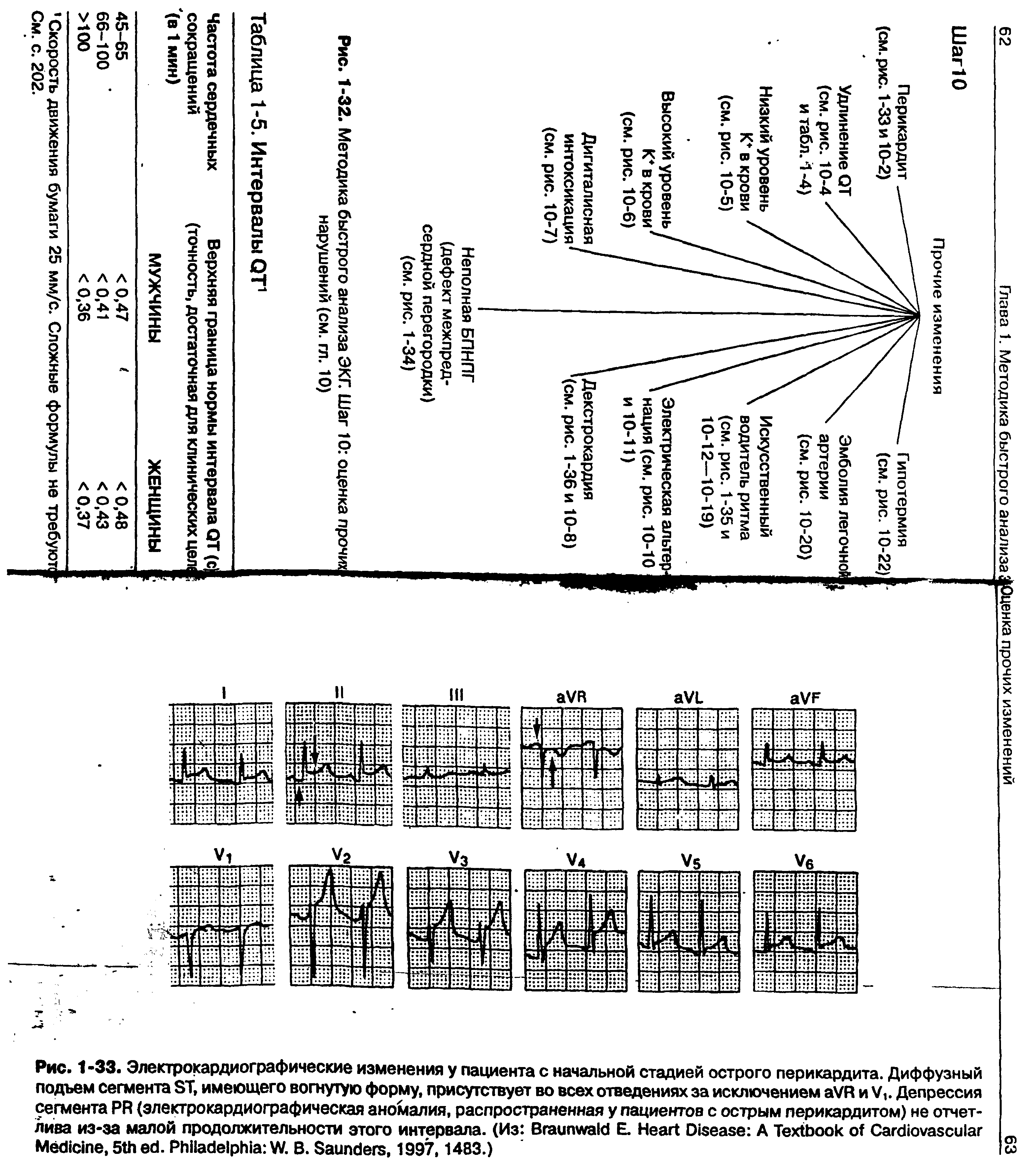 Рис. 1-32. Методика быстрого анализа ЭКГ. Шаг 10 оценка прочих нарушений (см. гл. 10)...