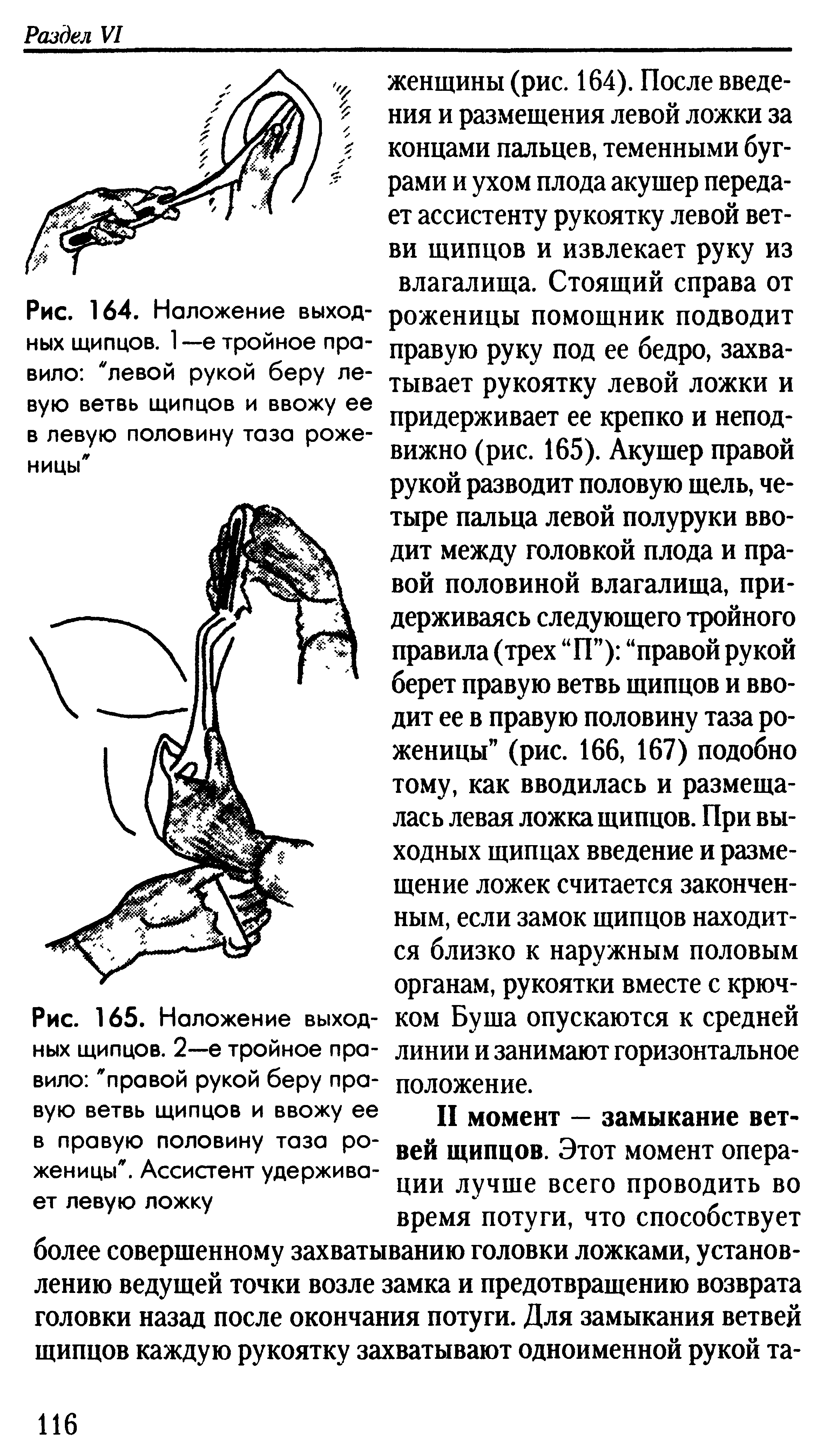 Рис. 165. Наложение выходных щипцов. 2—е тройное правило "правой рукой беру пра-...