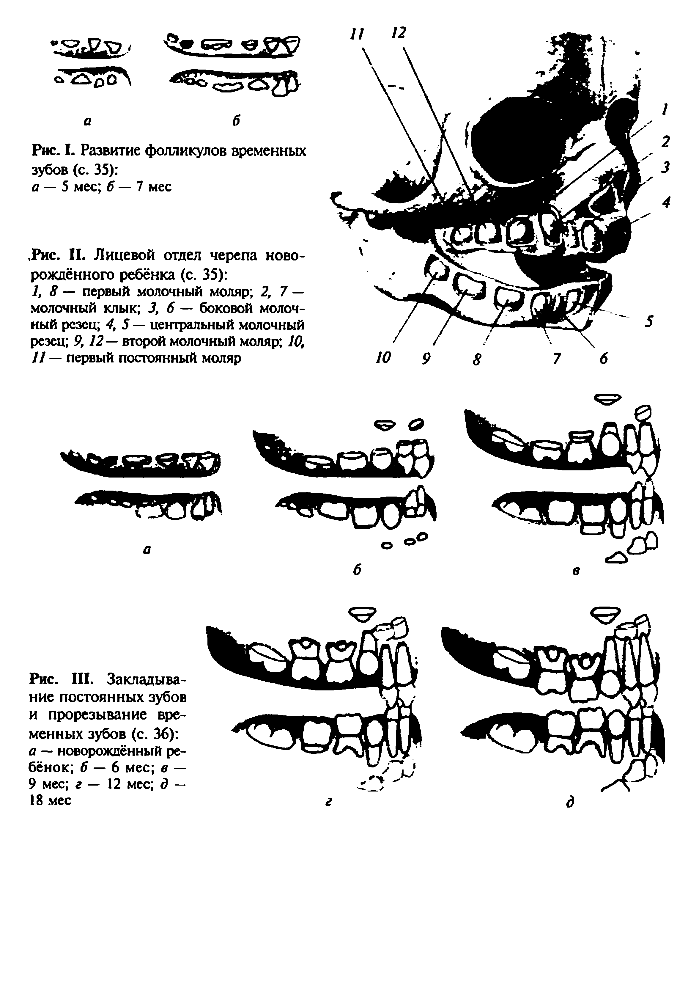 Рис. III. Закладывание постоянных зубов и прорезывание временных зубов (с. 36) а — новорождённый ребёнок б — 6 мес в — 9 мес г — 12 мес д — 18 мес...