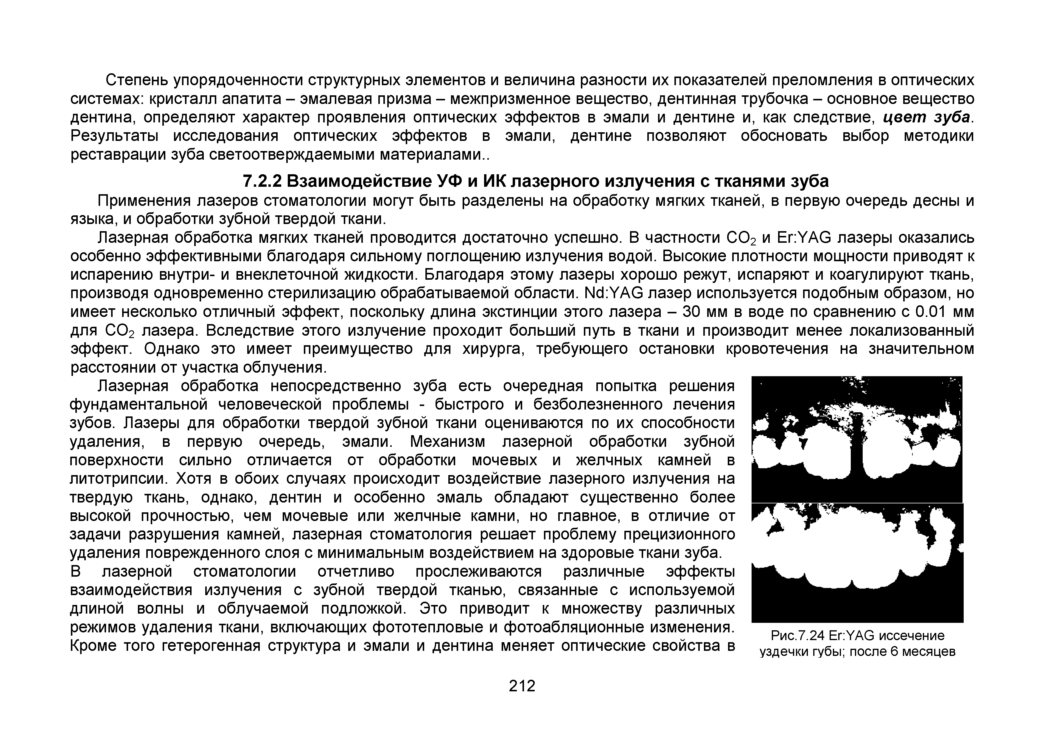 Рис.7.24 ЕсУАЭ иссечение уздечки губы после 6 месяцев...