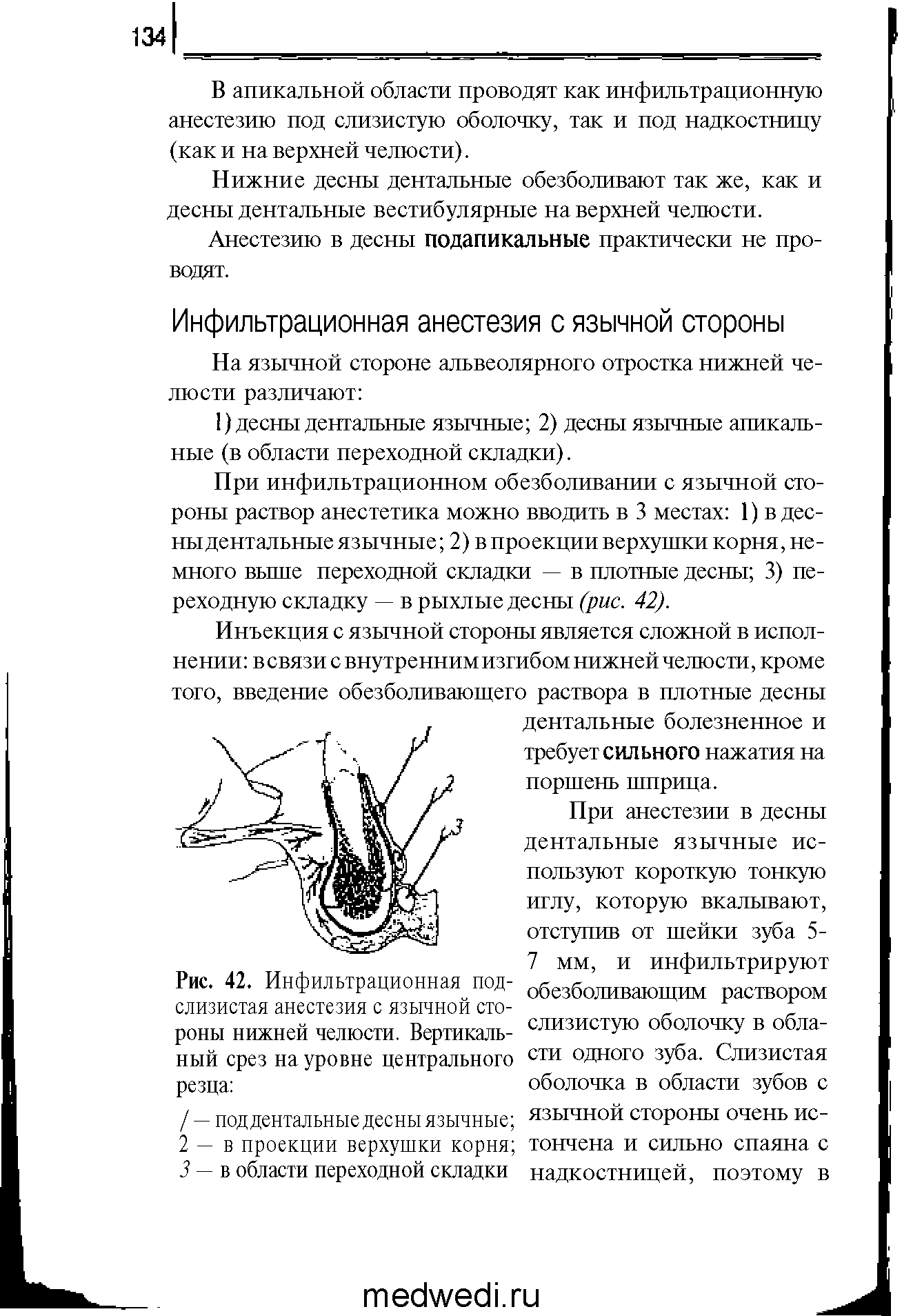 Рис. 42. Инфильтрационная подслизистая анестезия с язычной стороны нижней челюсти. Вертикальный срез на уровне центрального резца ...