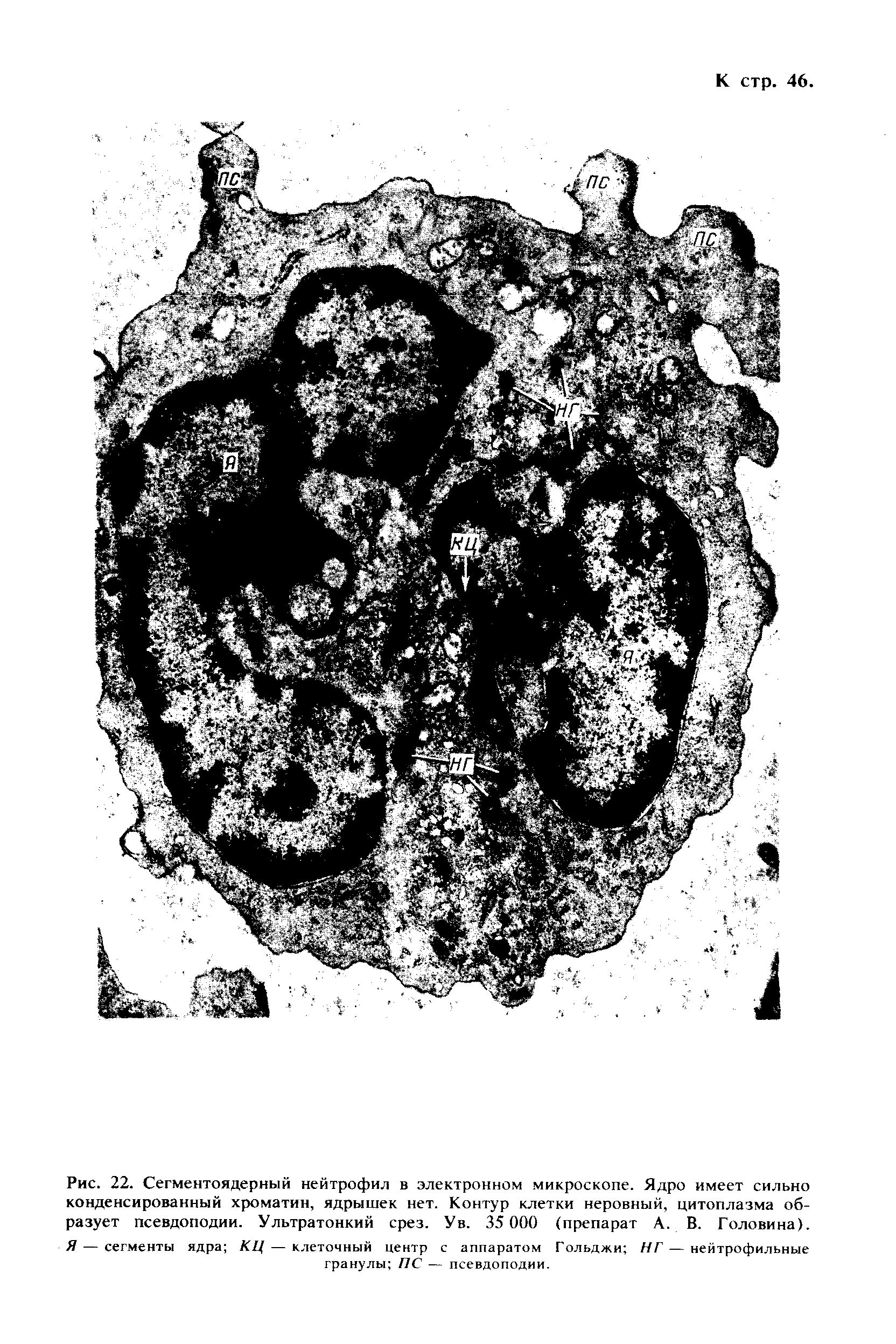 Рис. 22. Сегментоядерный нейтрофил в электронном микроскопе. Ядро имеет сильно конденсированный хроматин, ядрышек нет. Контур клетки неровный, цитоплазма образует псевдоподии. Ультратонкий срез. Ув. 35 000 (препарат А. В. Головина). Я — сегменты ядра КЦ — клеточный центр с аппаратом Гольджи НГ — нейтрофильные гранулы 77С — псевдоподии.