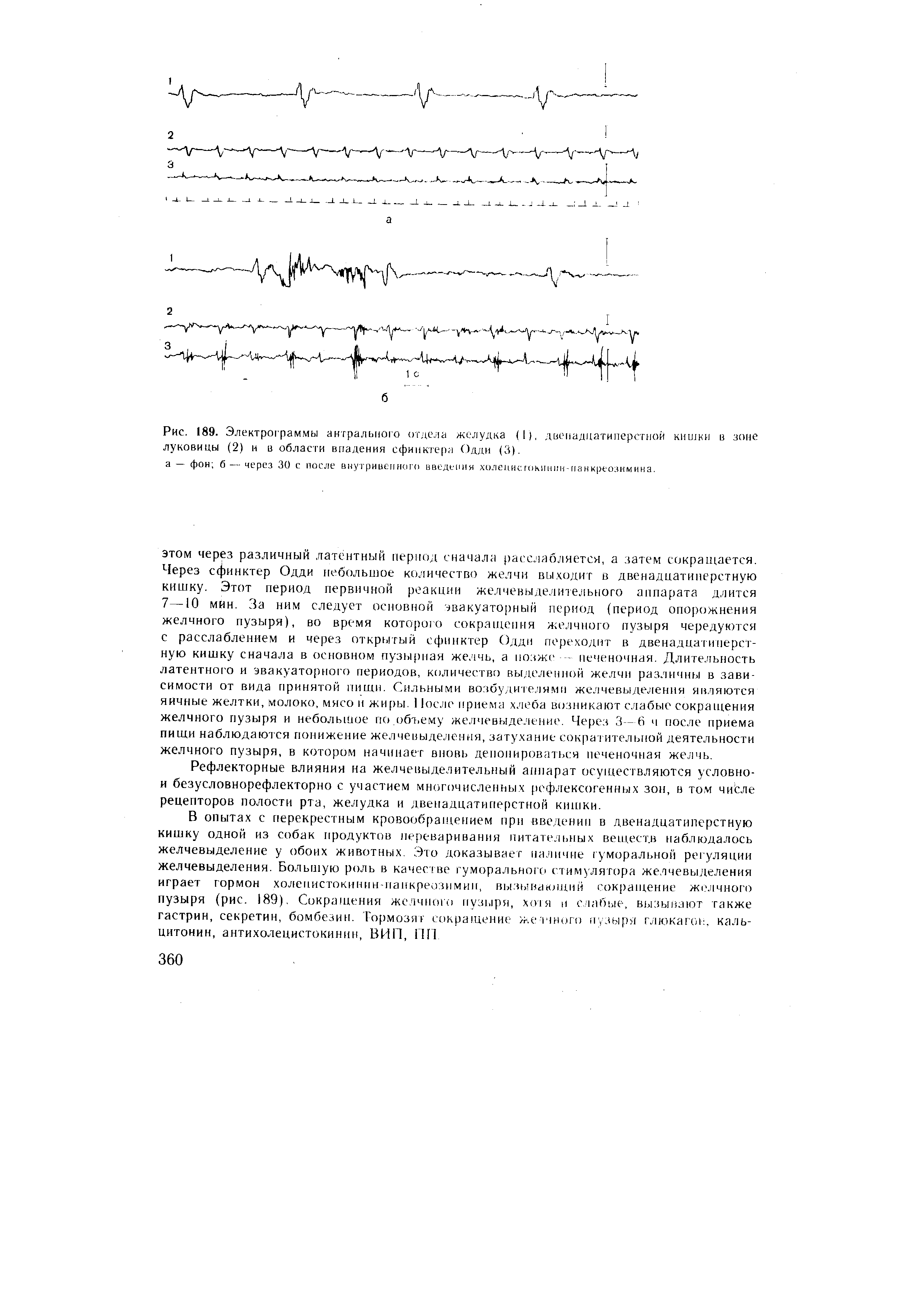 Рис. 189. Электрограммы антрального отдела желудка (I), двенадцатиперстной кишки в зоне луковицы (2) и в области впадения сфинктера Одди (3).