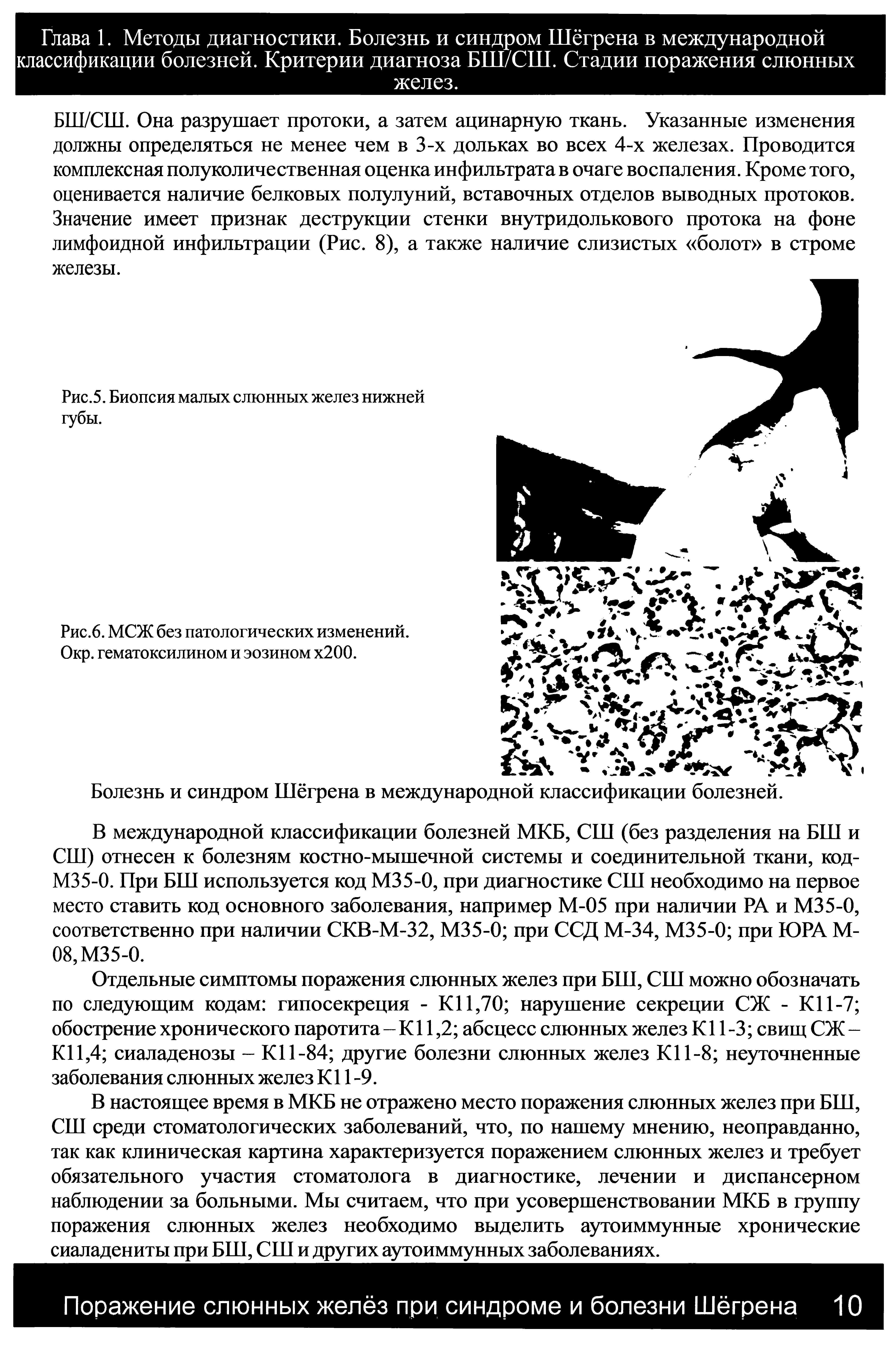 Рис.5. Биопсия малых слюнных желез нижней губы.