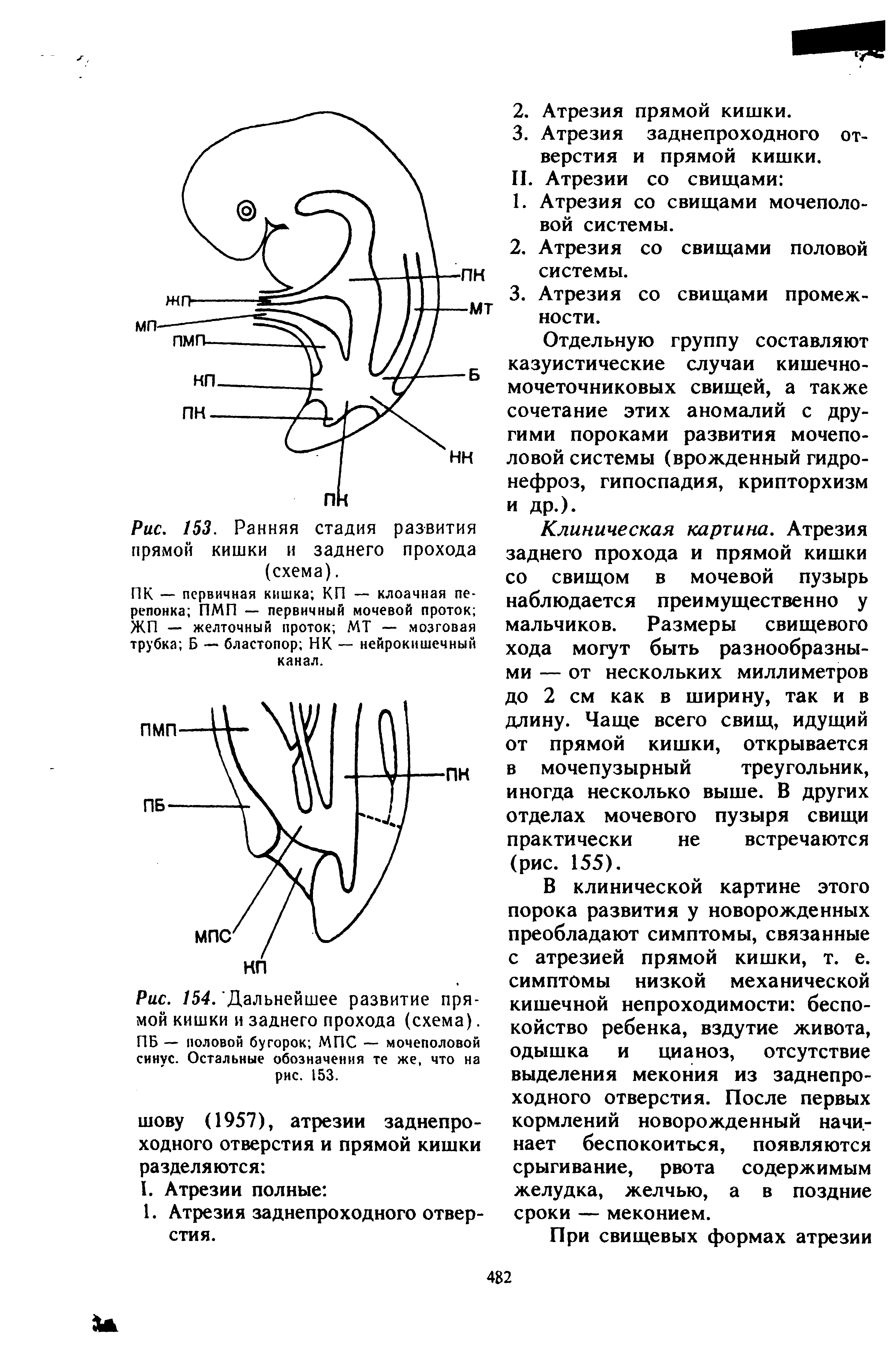 Рис. 154. Дальнейшее развитие прямой кишки и заднего прохода (схема). ПБ — половой бугорок МПС — мочеполовой синус. Остальные обозначения те же, что на рис. 153.