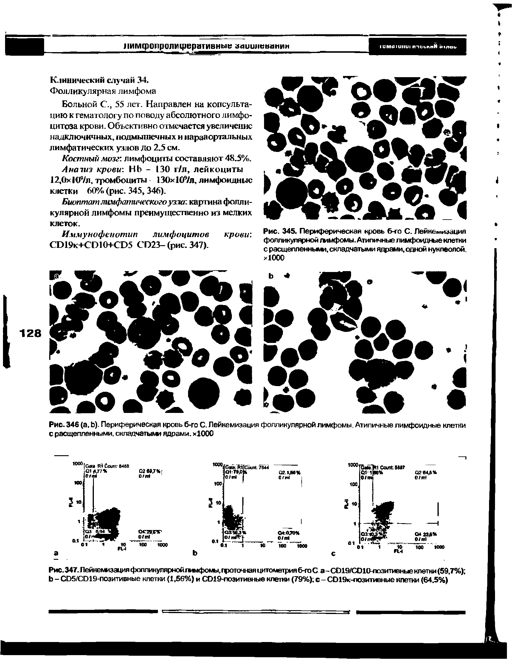 Рис.347. Лейкемизация фолликулярной лимфомы, гроточная цитометрия 6-го С а - С019/С010-лозитивные клетки (59,7%) Ь - СЬ5/СО19-позитивные клетки (1,56%) и СО19-позитивные клетки (79%) с - СО19к-позитивные клетки (64.5%)...