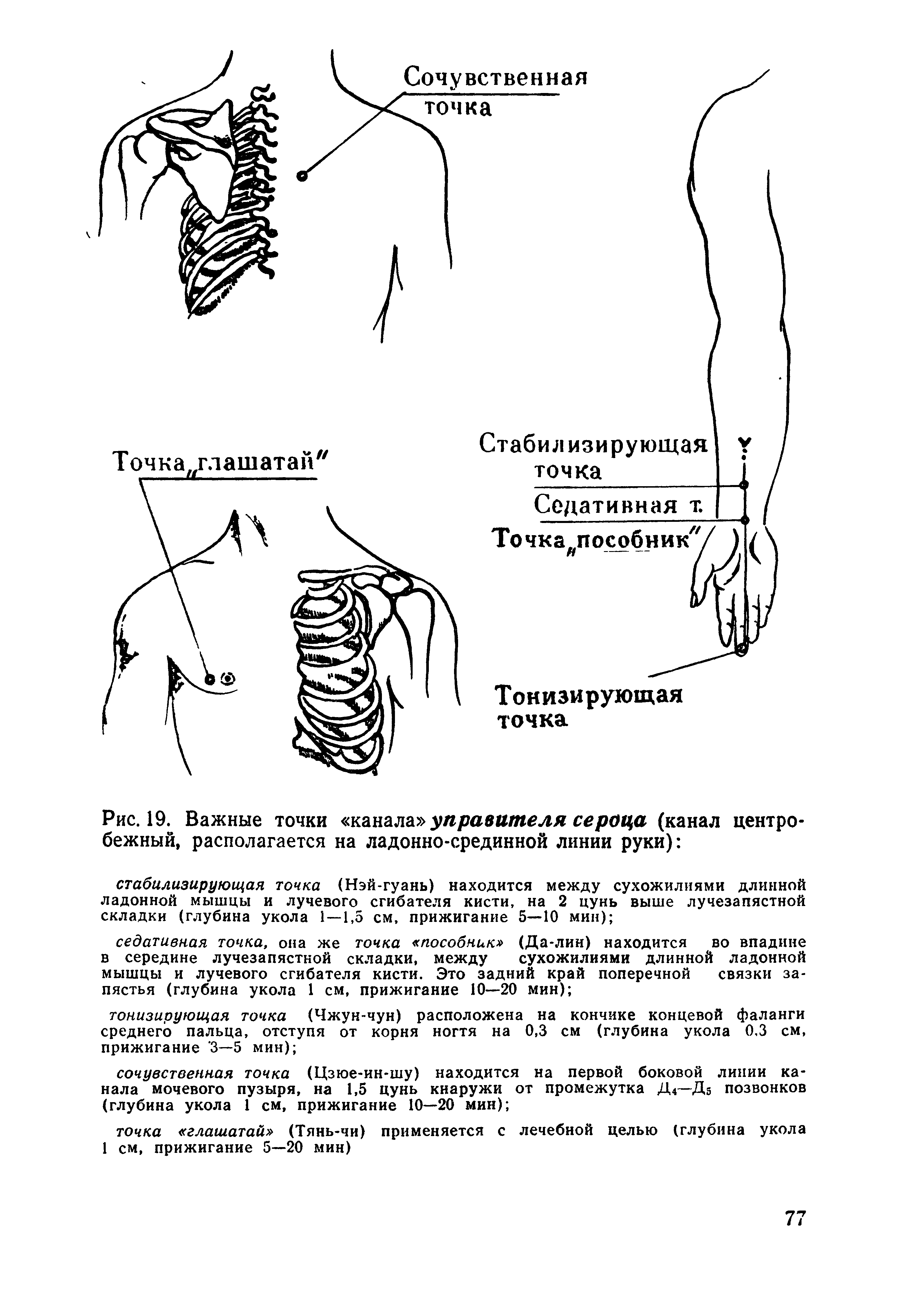 Рис. 19. Важные точки канала управителя сероца (канал центробежный, располагается на ладонно-срединной линии руки) ...