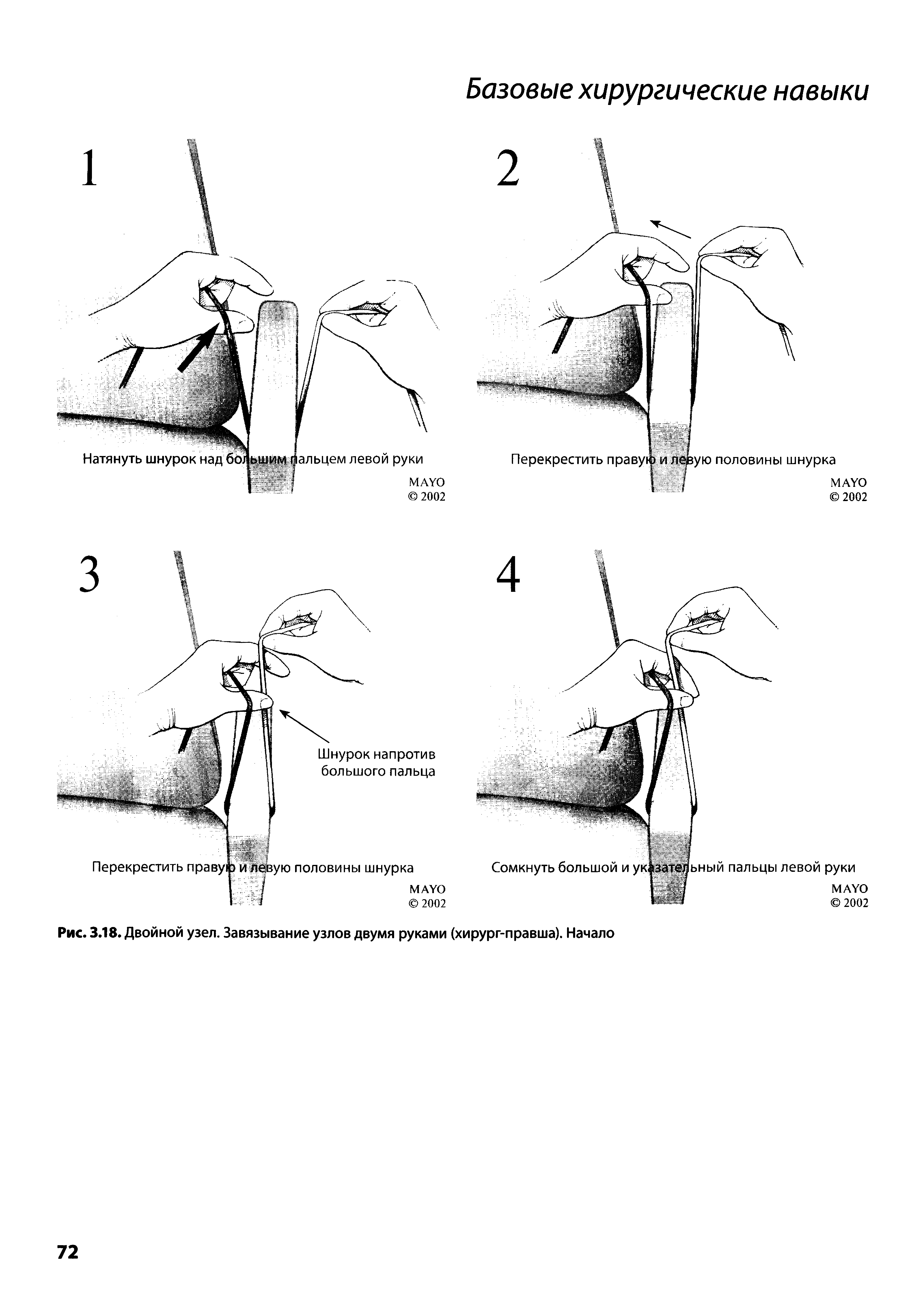 Рис. 3.18. Двойной узел. Завязывание узлов двумя руками (хирург-правша). Начало...