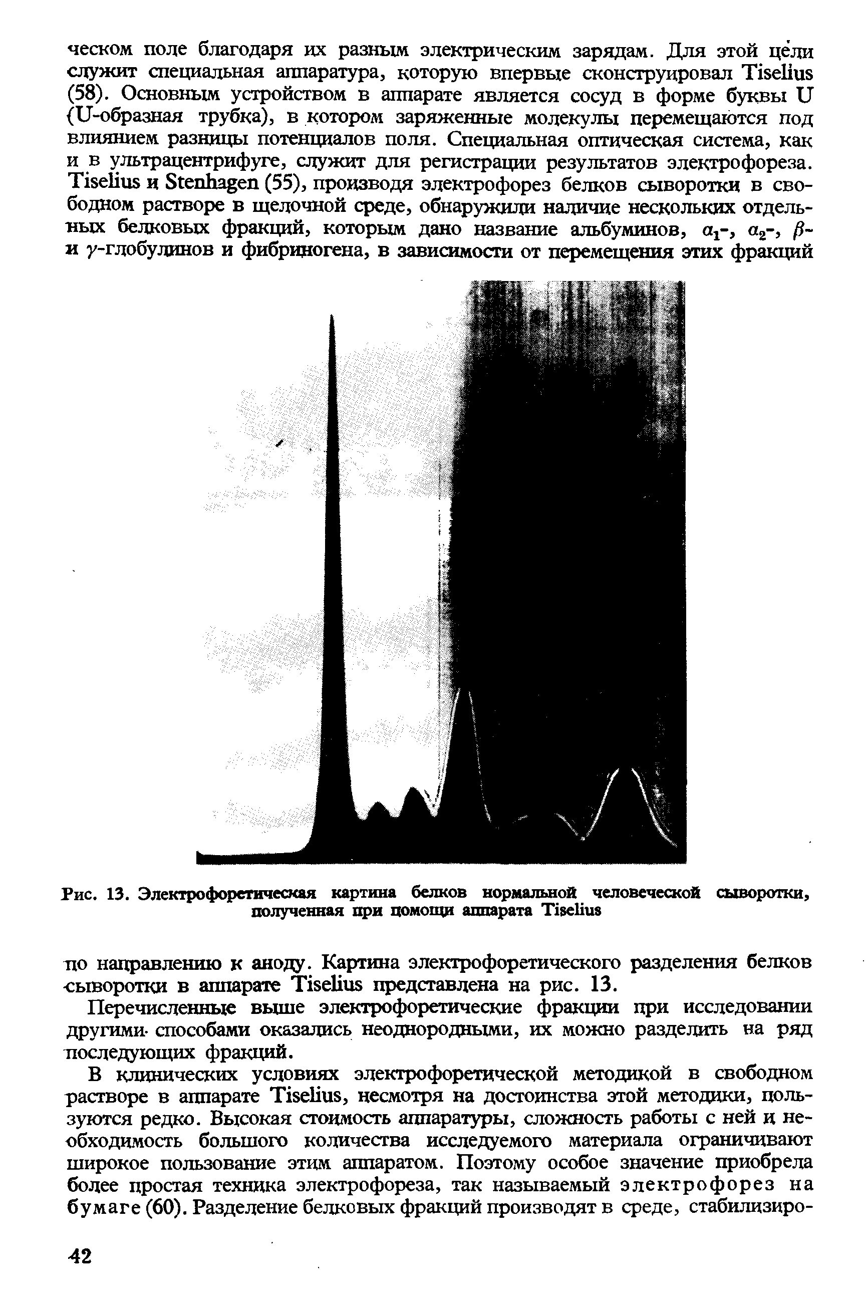 Рис. 13. Электрофоретическая картина белков нормальной человеческой сыворотки, полученная при помощи аппарата T ...