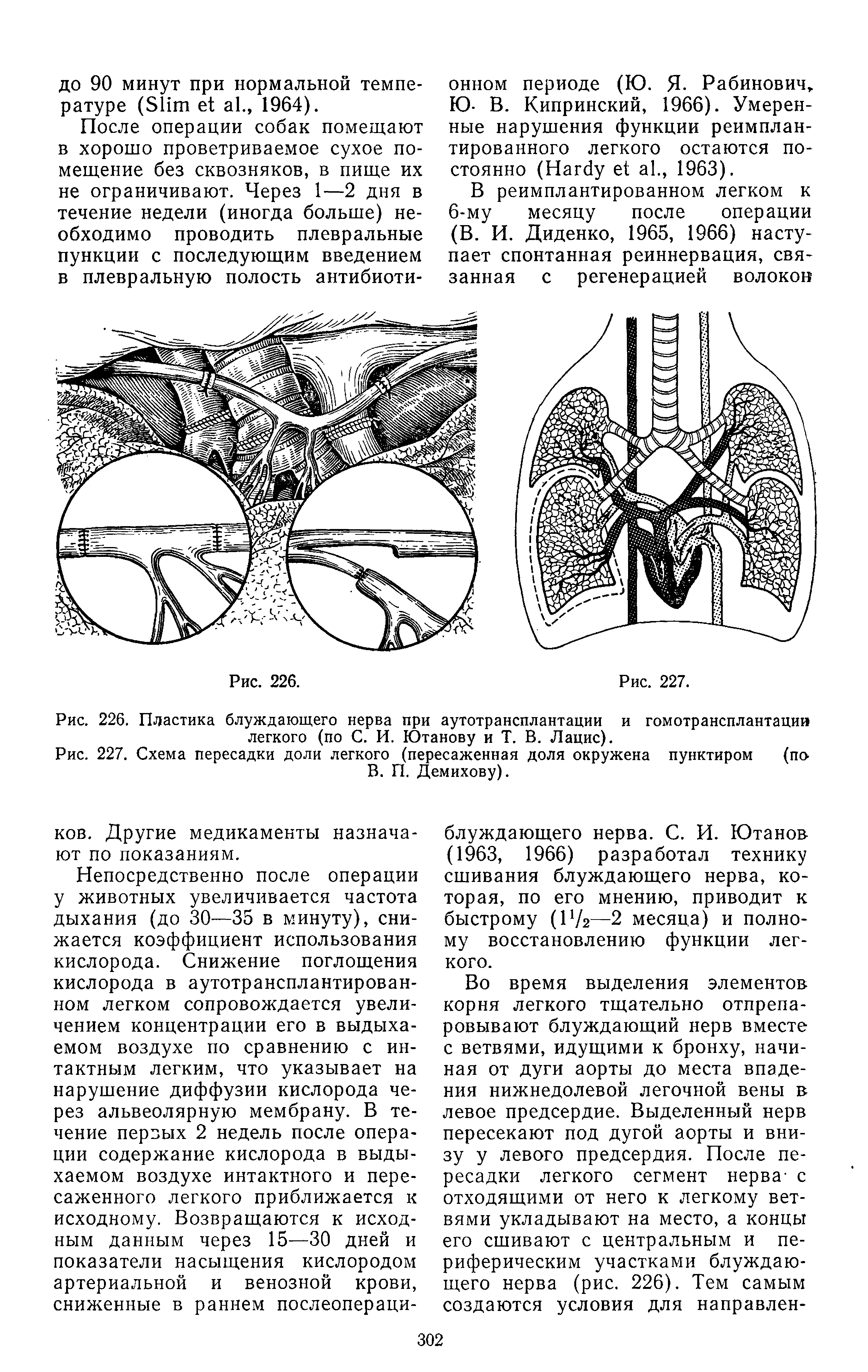 Рис. 226. Пластика блуждающего нерва при аутотрансплантации и гомотрансплантации легкого (по С. И. Ютанову и Т. В. Лацис).
