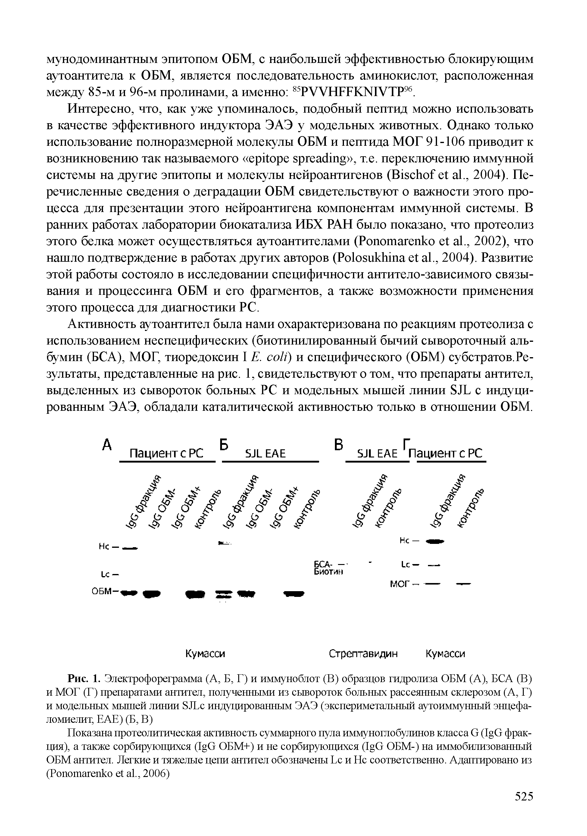 Рис. 1. Электрофореграмма (А, Б, Г) и иммуноблот (В) образцов гидролиза ОБМ (А), БСА (В) и МОГ (Г) препаратами антител, полученными из сывороток больных рассеянным склерозом (А, Г) и модельных мышей линии SJL индуцированным ЭАЭ (экспериметальный аутоиммунный энцефаломиелит, ЕАЕ) (Б, В)...