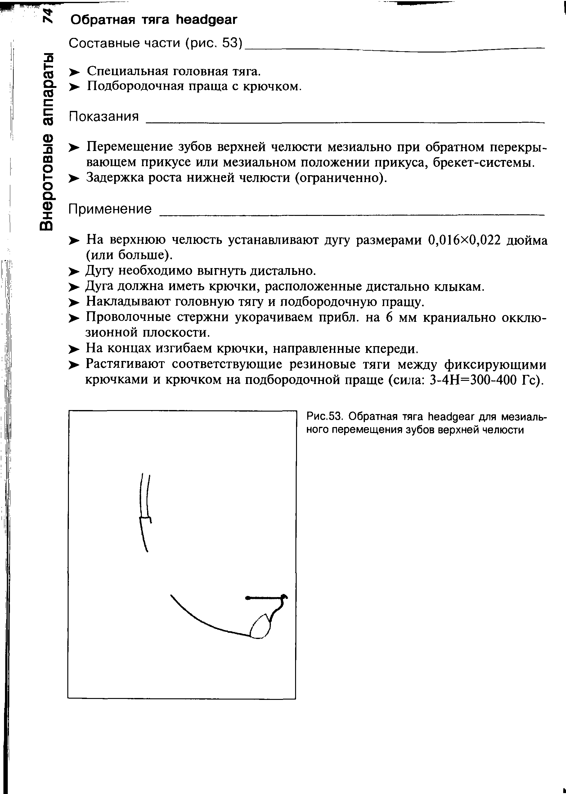 Рис.53. Обратная тяга для мезиального перемещения зубов верхней челюсти...