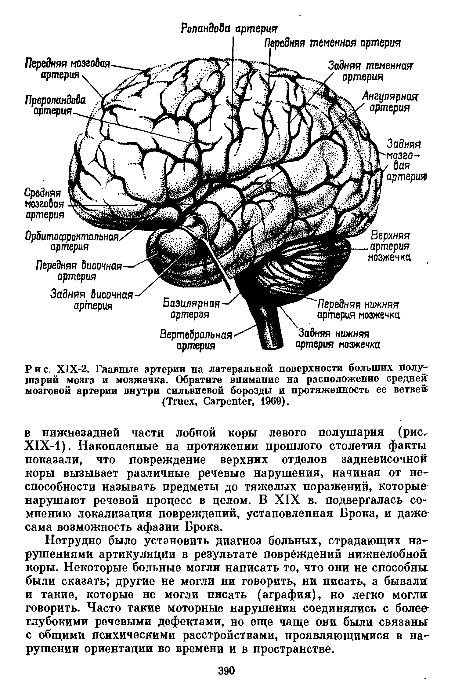 Рис. XIX-2. Главные артерии на латеральной поверхности больших полушарий мозга и мозжечка. Обратите внимание на расположение средней мозговой артерии внутри сильвиевой борозды и протяженность ее ветвей (T , C , 1969).