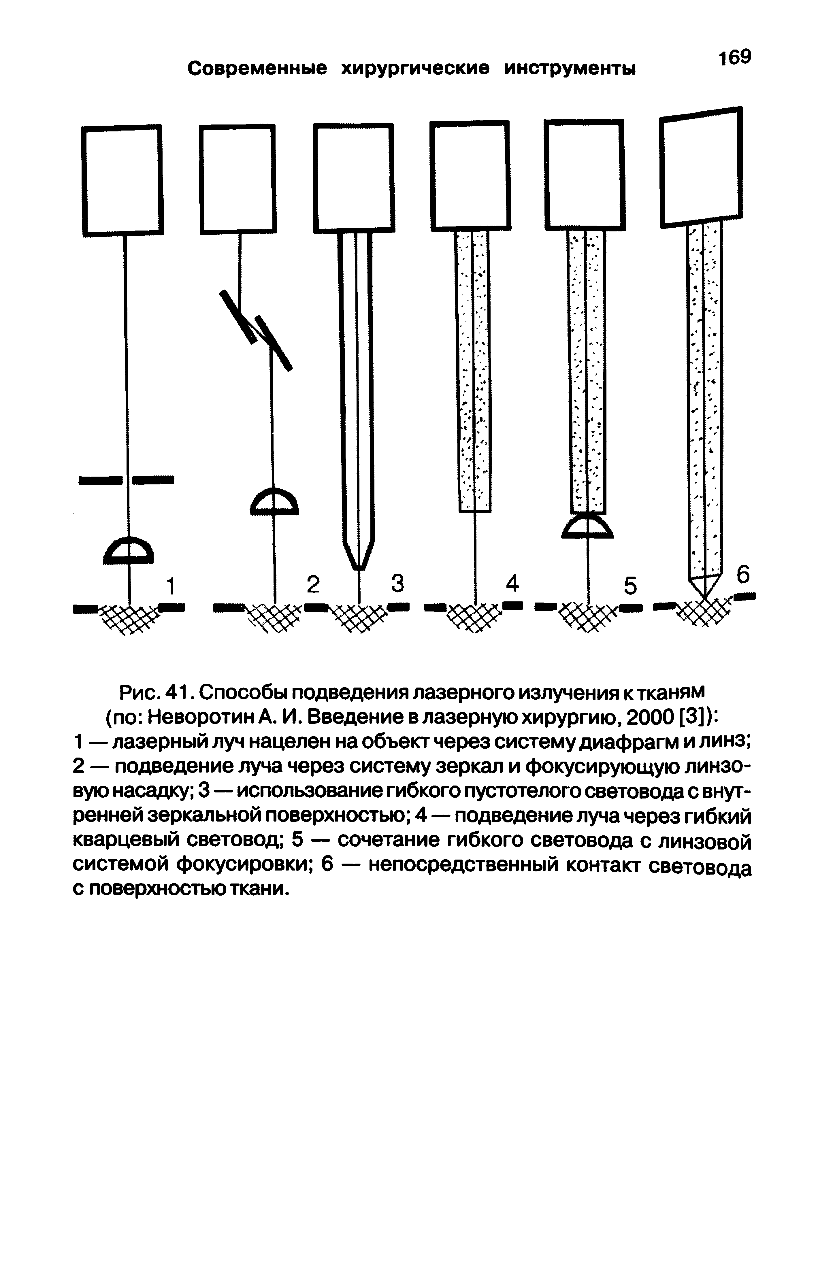 Рис. 41. Способы подведения лазерного излучения к тканям (по Неворотин А. И. Введение в лазерную хирургию, 2000 [3]) ...