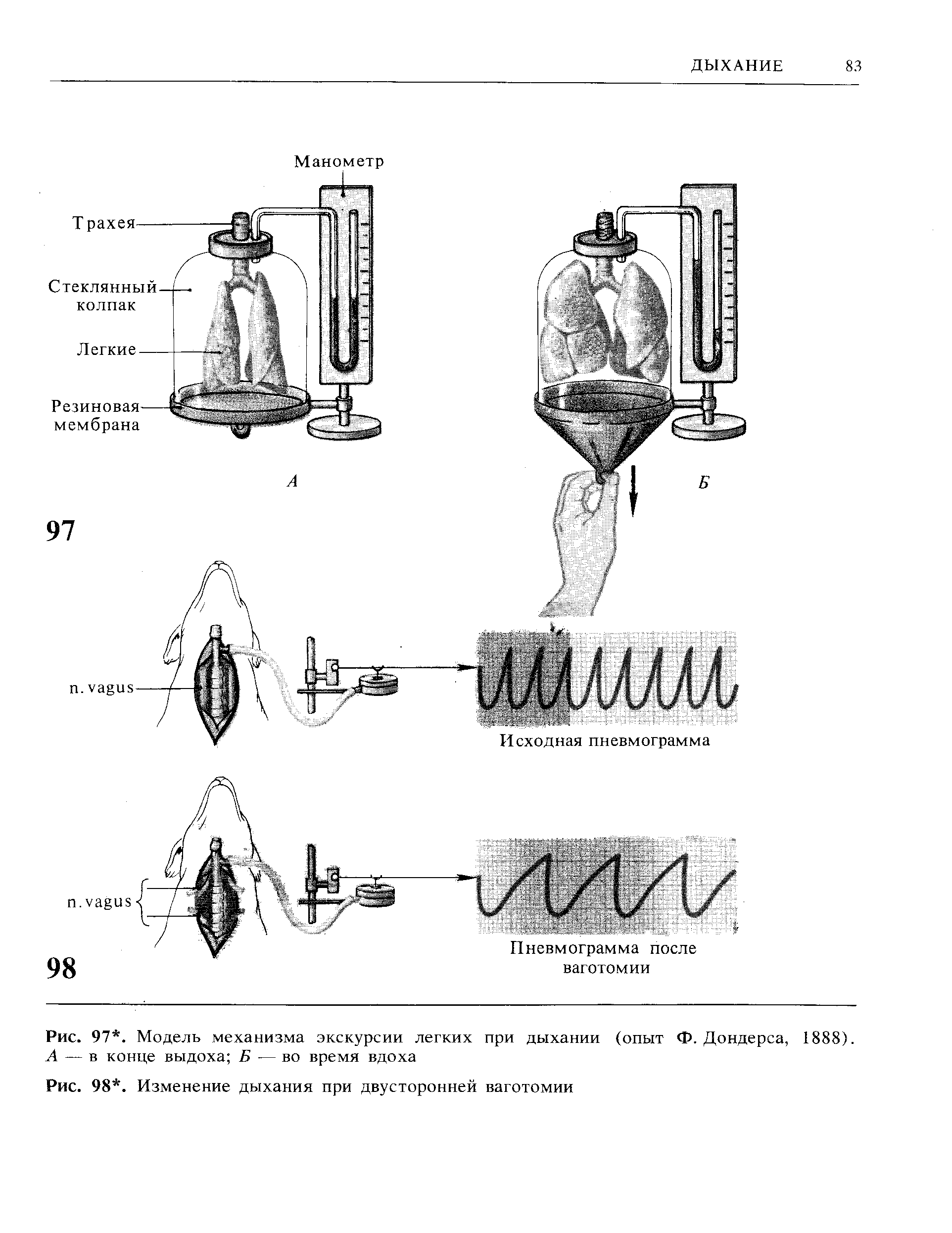 Рис. 97. Модель механизма экскурсии легких при дыхании (опыт Ф. Дондерса, 1888). А — в конце выдоха Б — во время вдоха...