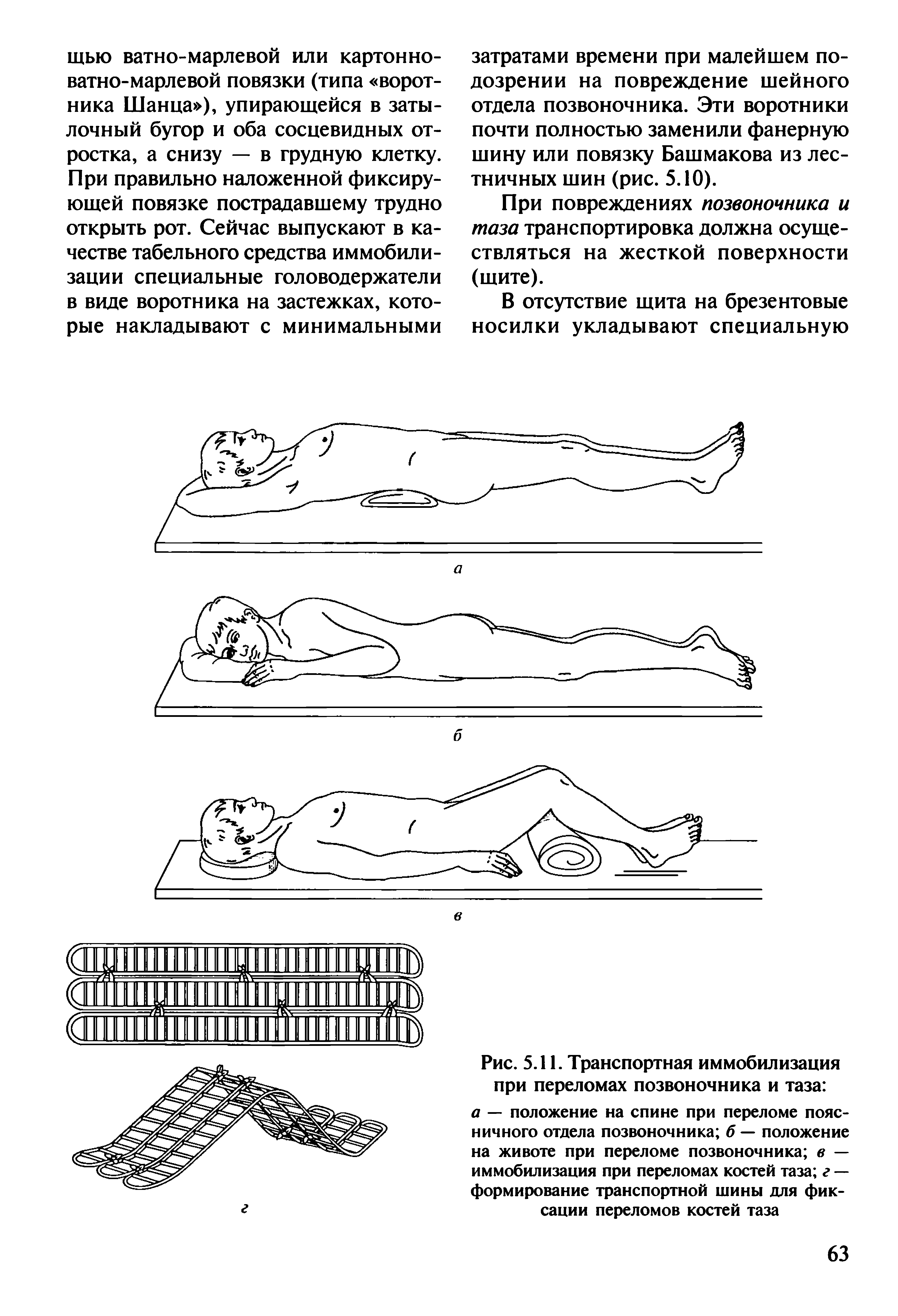 Рис. 5.11. Транспортная иммобилизация при переломах позвоночника и таза а — положение на спине при переломе поясничного отдела позвоночника б — положение на животе при переломе позвоночника в — иммобилизация при переломах костей таза г — формирование транспортной шины для фиксации переломов костей таза...