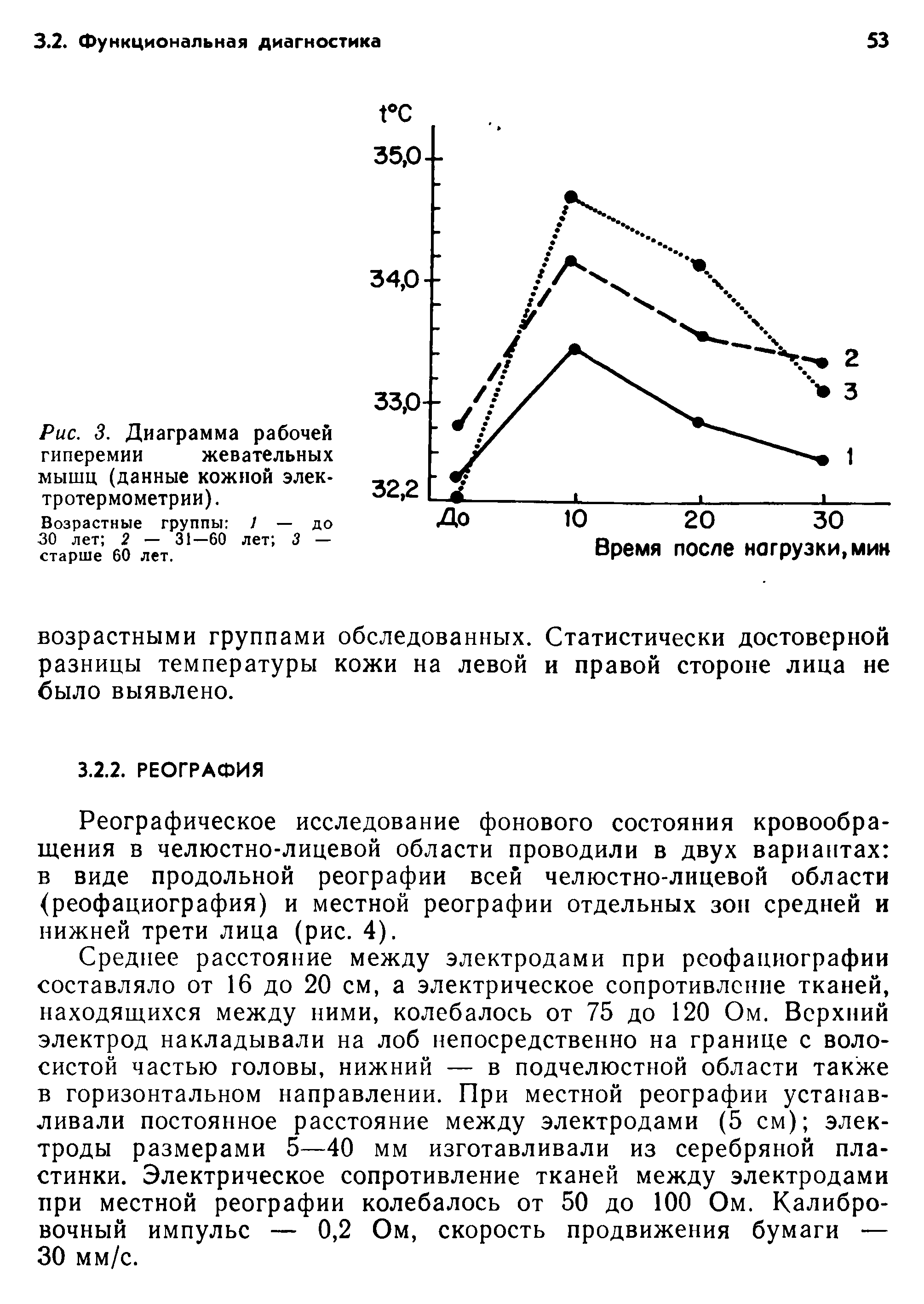 Рис. 3. Диаграмма рабочей гиперемии жевательных мышц (данные кожной электротермометрии).