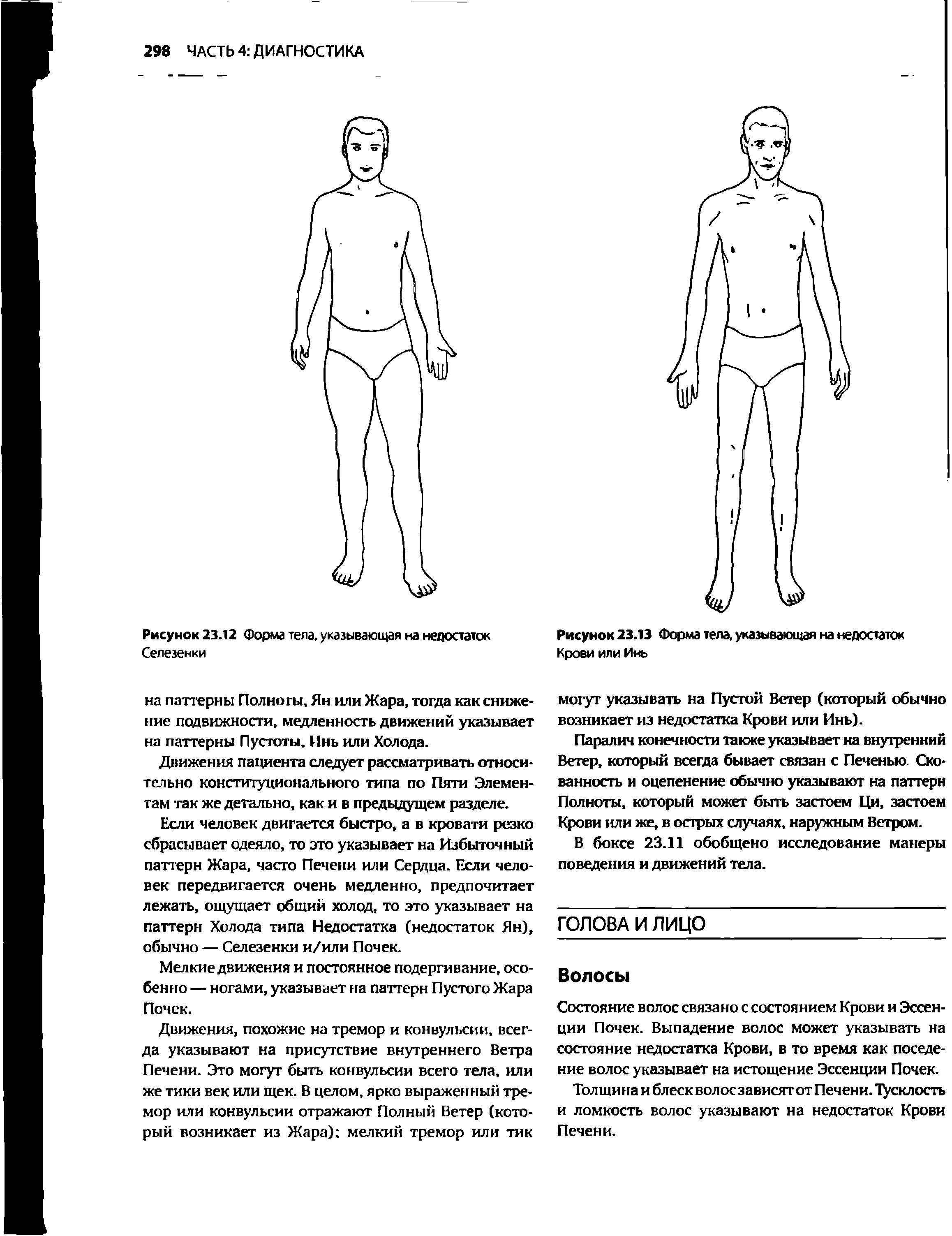 Рисунок 23.12 Форма тела, указывающая на недостаток Селезенки...