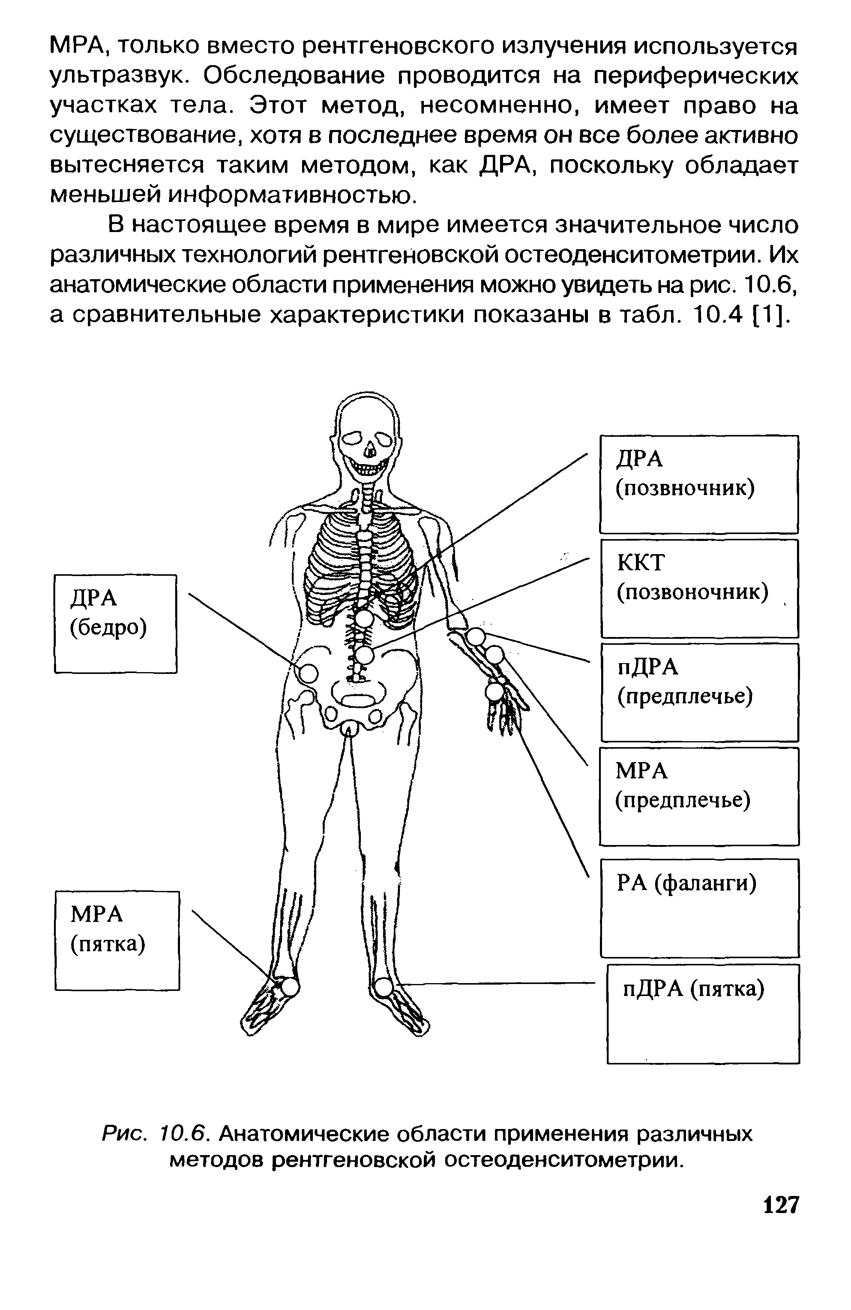 Рис. 10.6. Анатомические области применения различных методов рентгеновской остеоденситометрии.