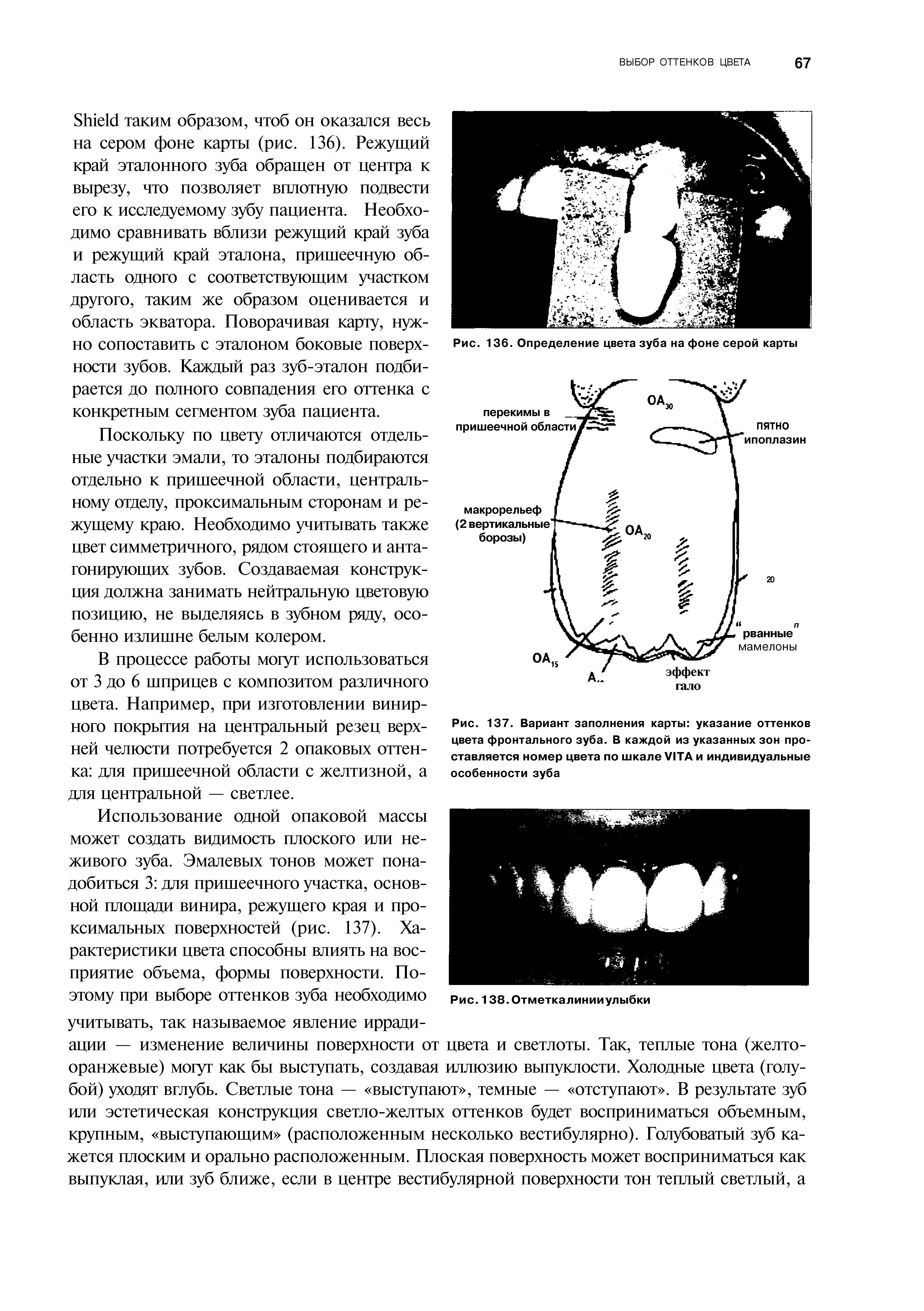 Рис. 136. Определение цвета зуба на фоне серой карты...