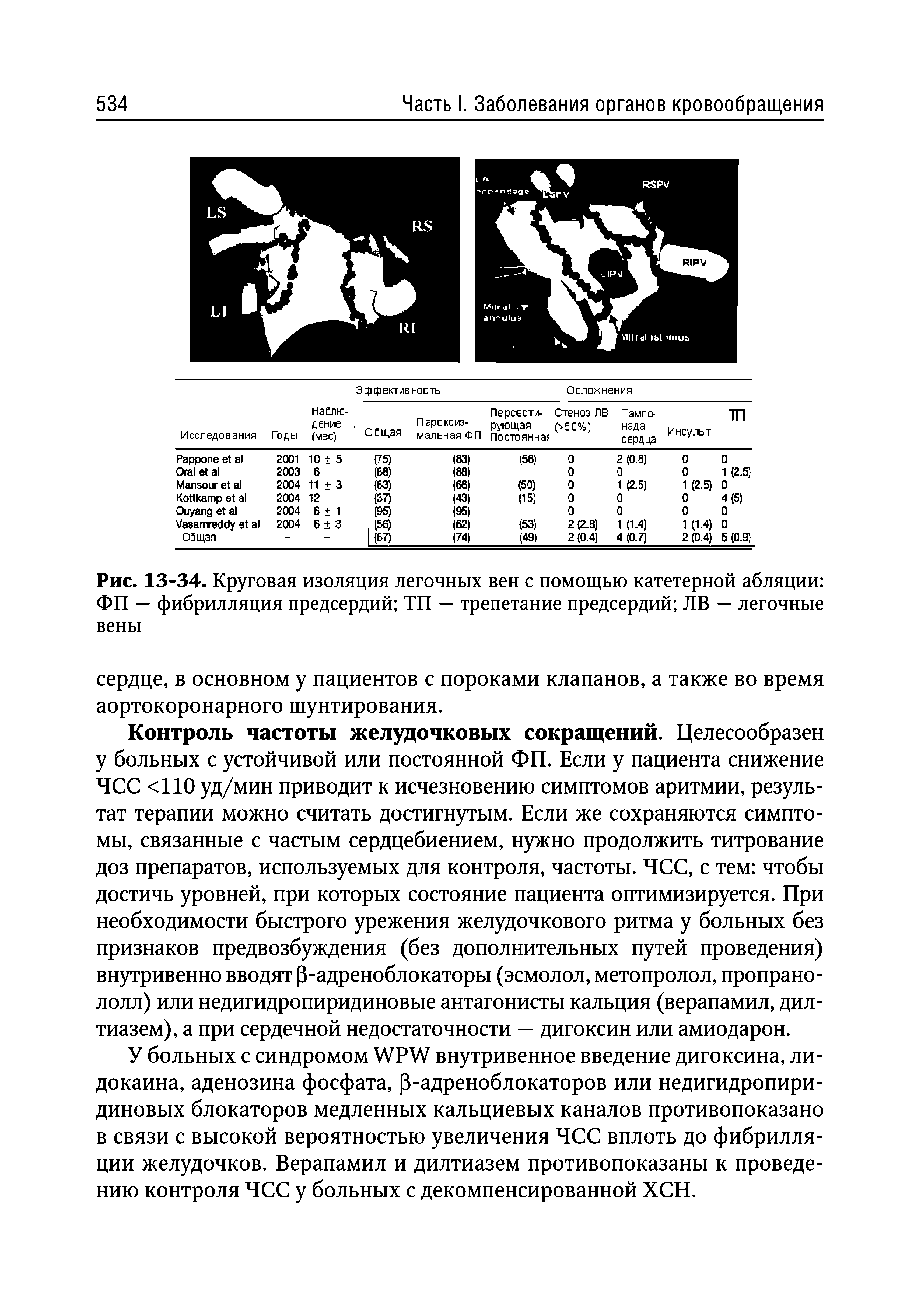 Рис. 13-34. Круговая изоляция легочных вен с помощью катетерной абляции ФП — фибрилляция предсердий ТП — трепетание предсердий ЛВ — легочные вены...