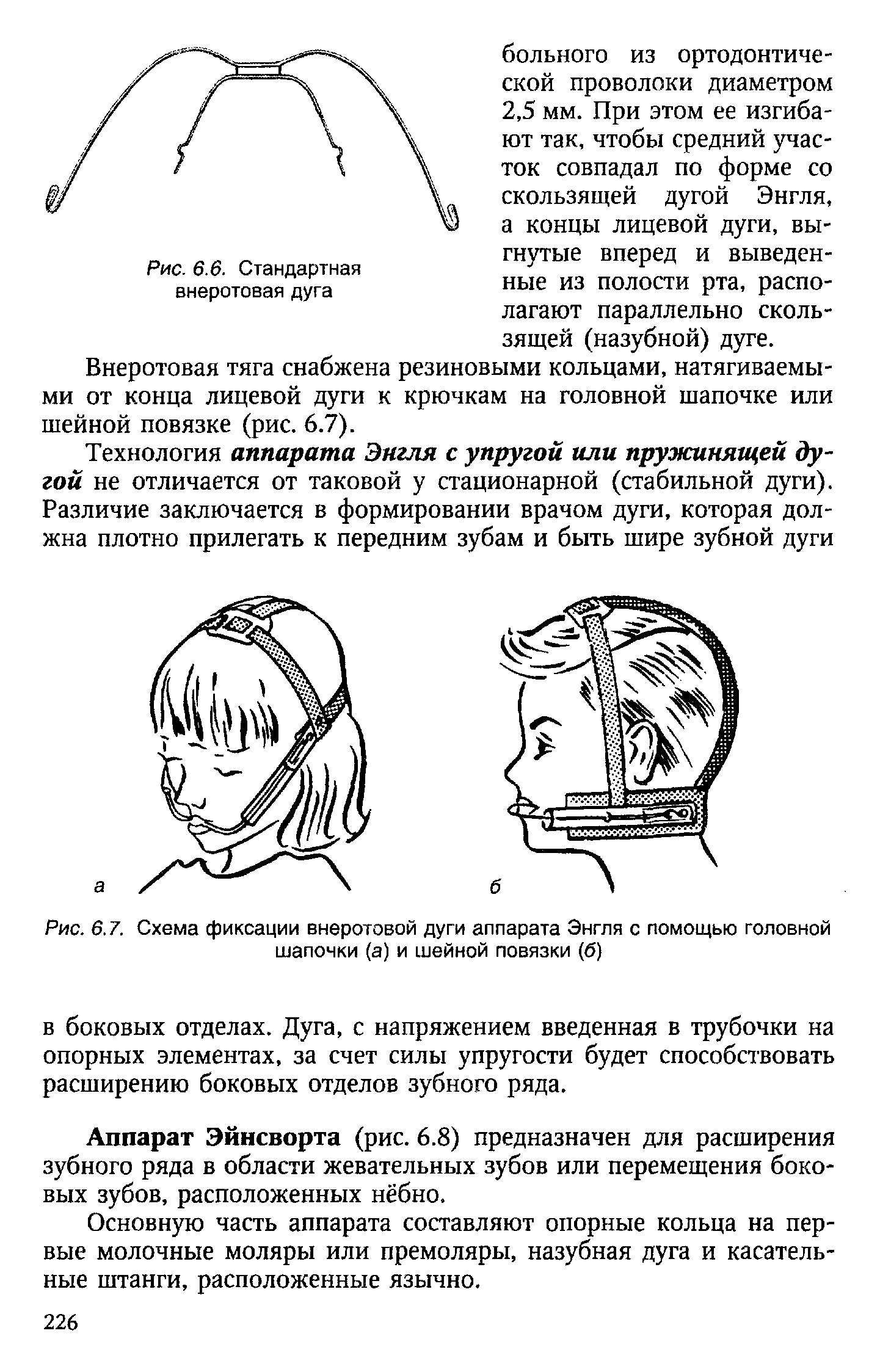 Рис. 6.7. Схема фиксации внеротовой дуги аппарата Энгля с помощью головной шапочки (а) и шейной повязки (б)...