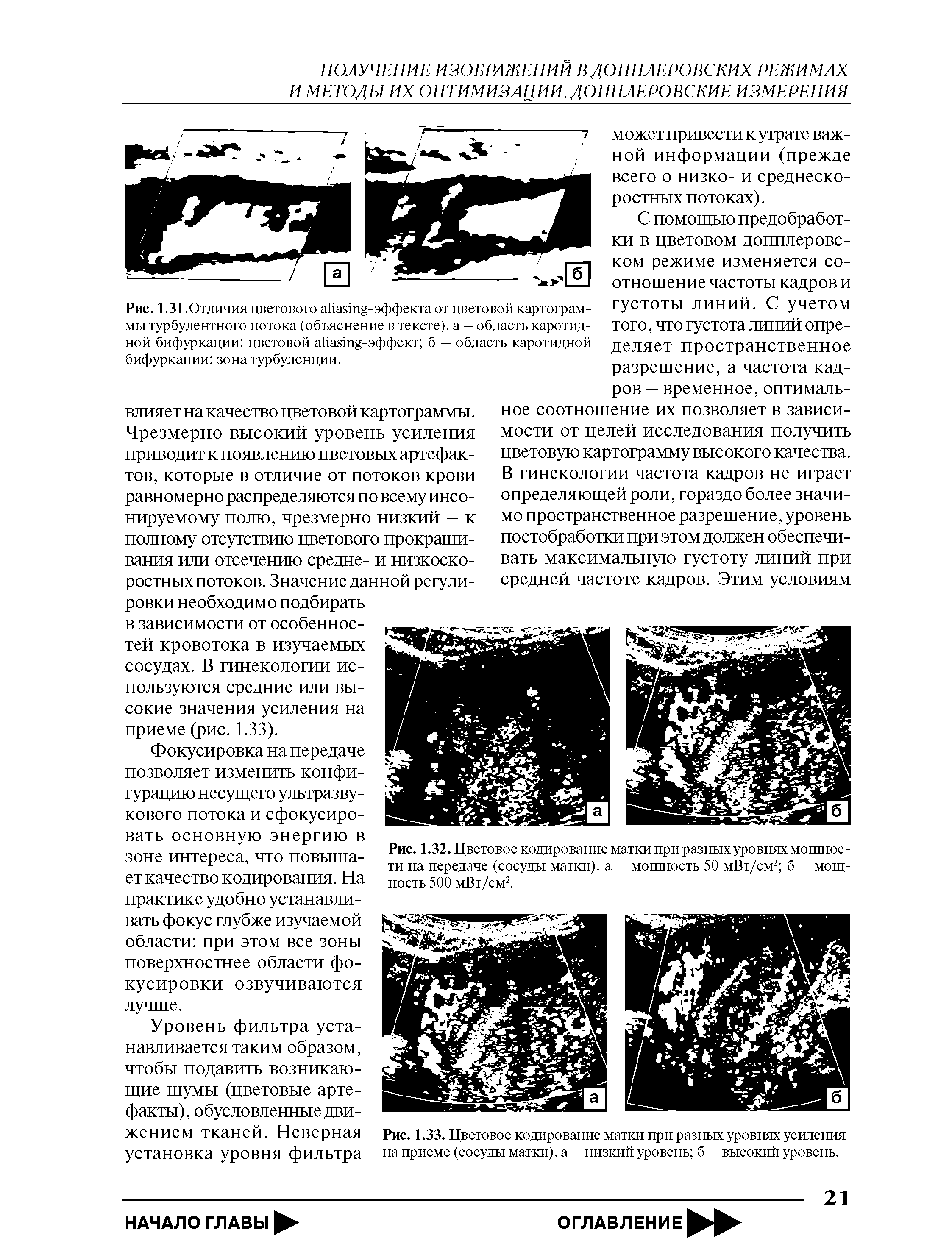 Рис. 1.32. Цветовое кодирование матки при разных уровнях мощности на передаче (сосуды матки), а — мощность 50 мВт/см2 б — мощность 500 мВт/см2.