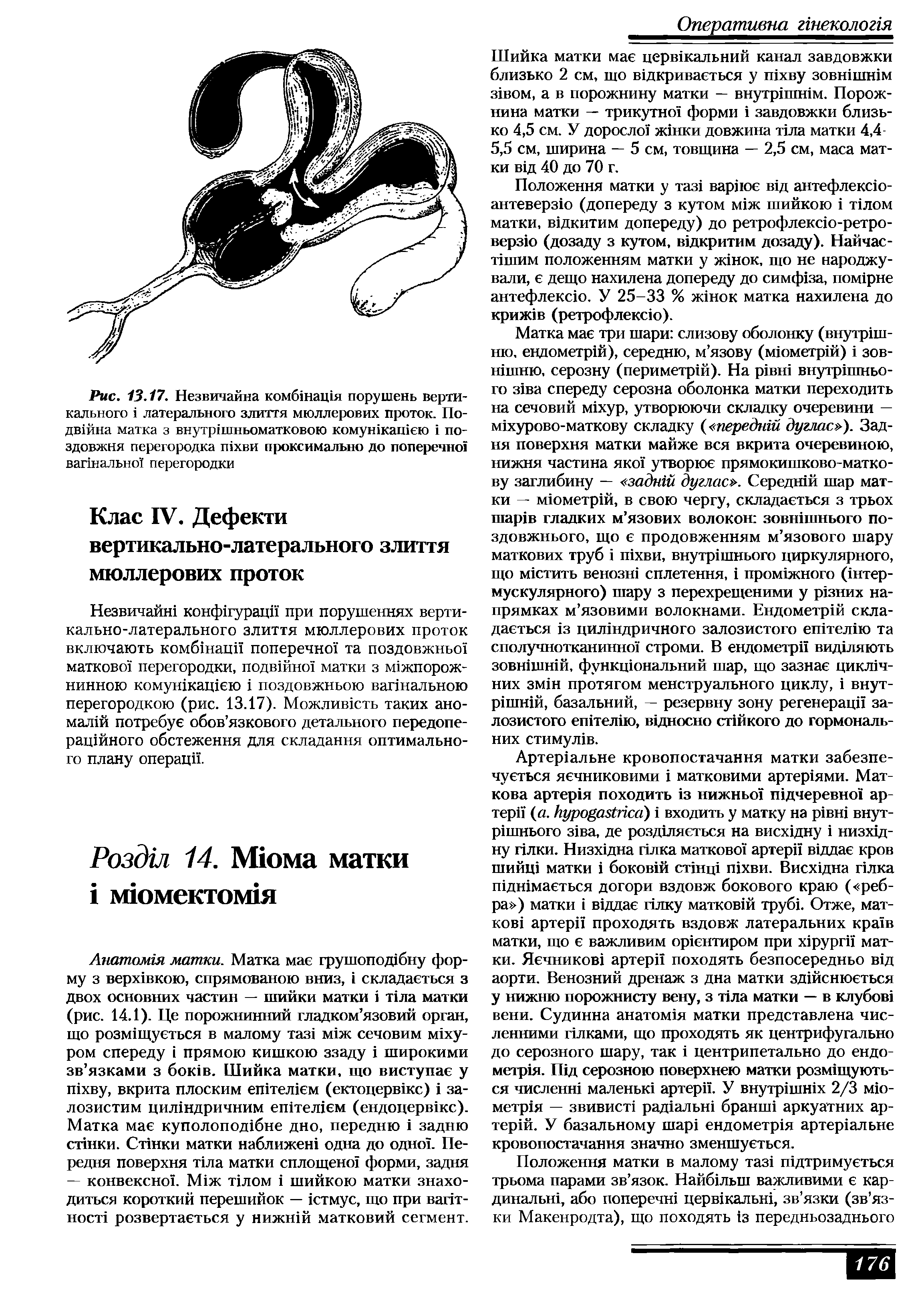 Рис. 13.17. Незвичайна комбшащя порушень вертикального 1 латерального злиття мюллерових проток. По-двшна матка з внутр шпьоматковою комушкашею 1 по-здовжня перегородка П1хви проксимально до поперечно вапнально перегородки...