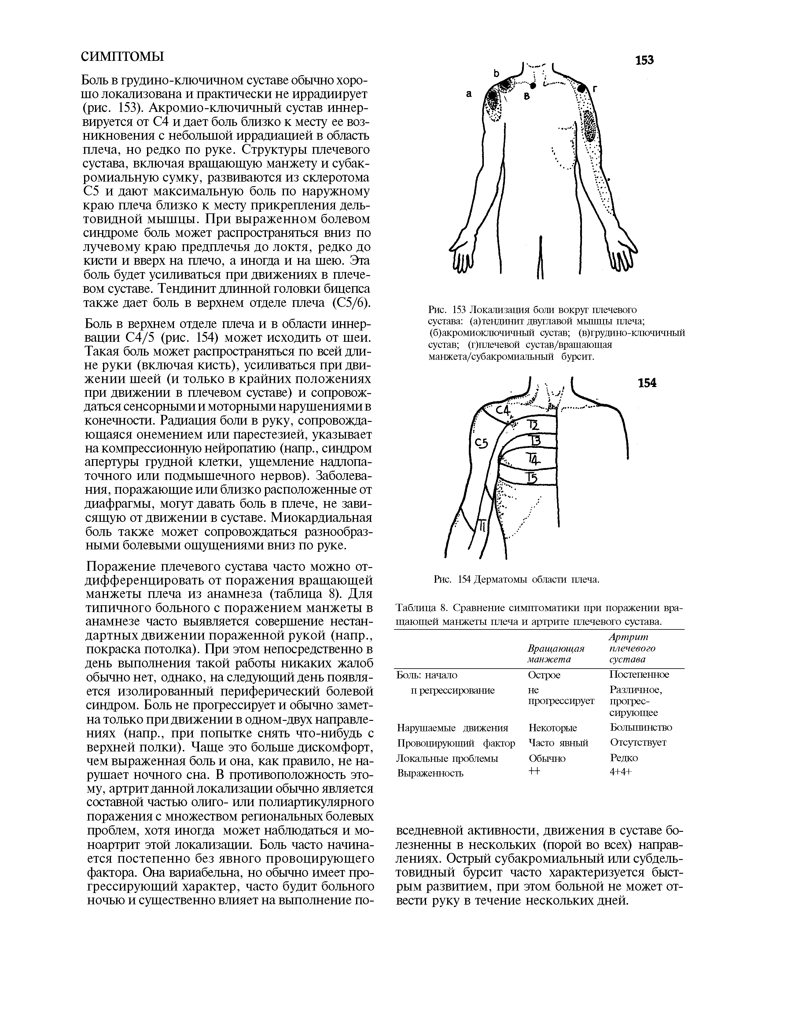 Рис. 153 Локализация боли вокруг плечевого сустава (а)тендинит двуглавой мышцы плеча ...