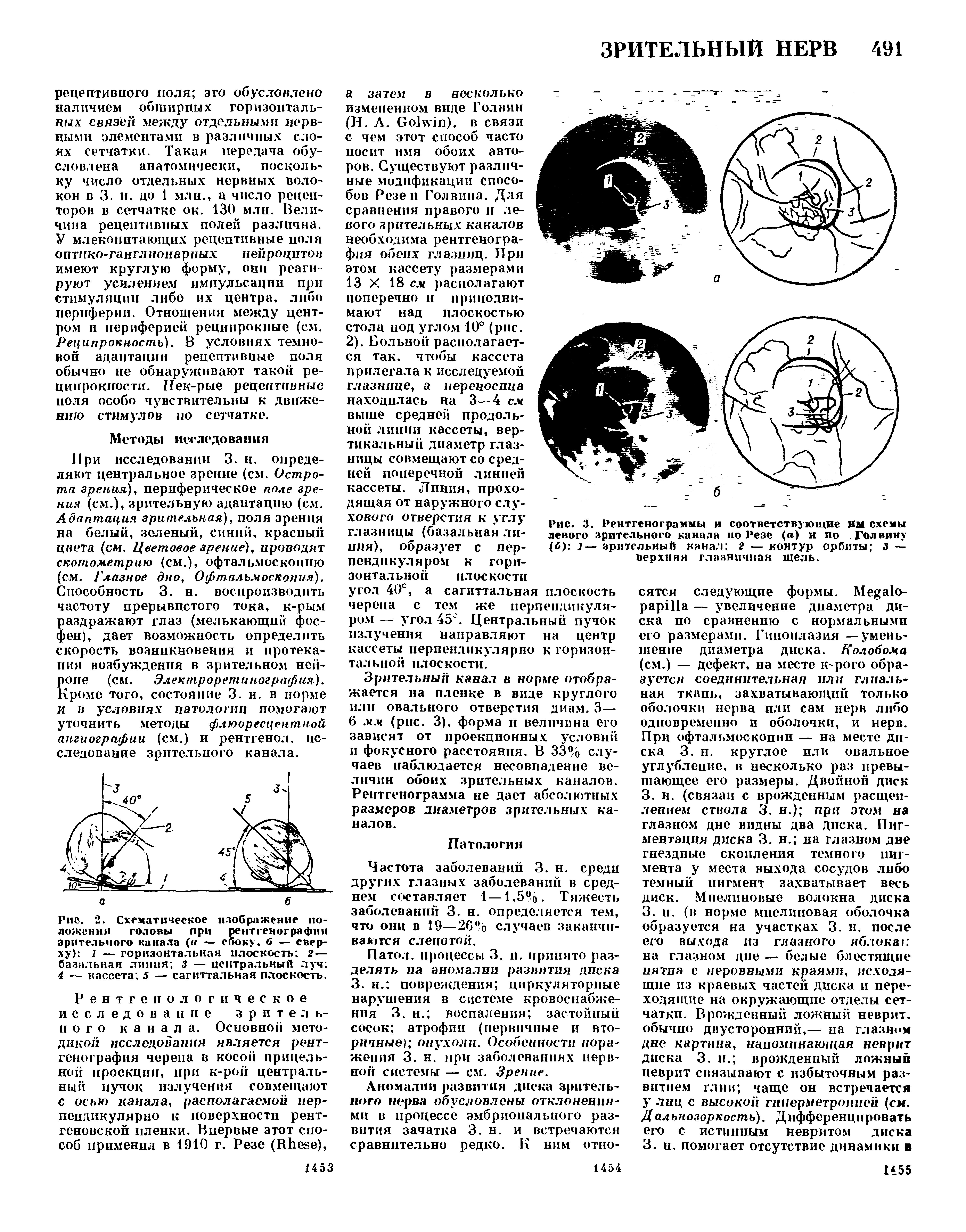 Рис. 2. Схематическое изображение положения головы при рентгенографии зрительного канала ( — сбоку. 6 — сверху) 1 — горизонтальная плоскость 2— базальная линия 3 — центральный луч 4 — кассета 5 — сагиттальная плоскость.